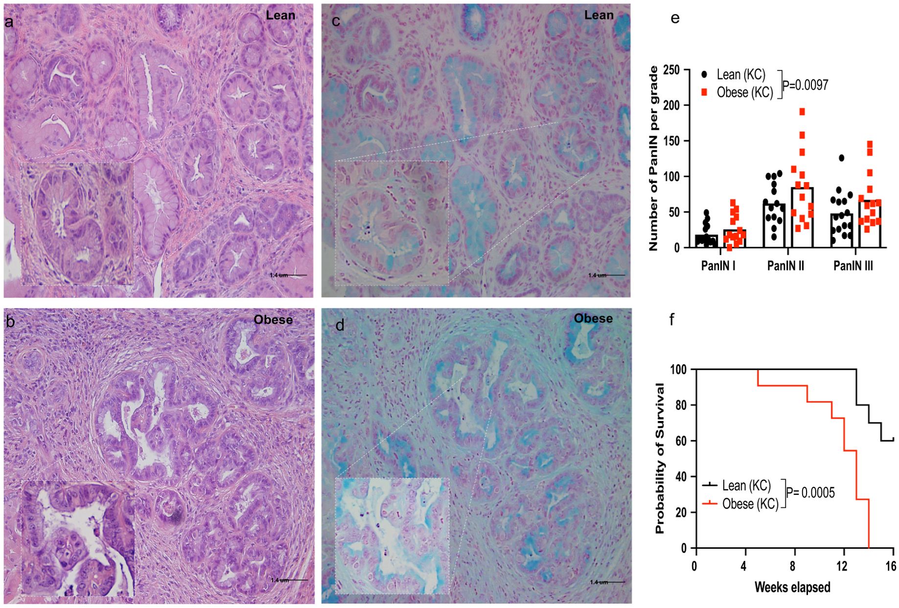 The image contains a six-panel figure. Panels a and b show hematoxylin and eosin-stained pancreatic tissue from lean and obese subjects, respectively, highlighting differences in tissue structure. Panels c and d display Alcian blue staining sections of the same tissues. Panel e presents a bar chart comparing the number of pancreatic intraepithelial neoplasia (PanIN) lesions in lean and obese subjects across three grades, with statistical significance noted. Panel f is a survival curve indicating different probabilities of survival over time for lean and obese subjects, with a significant difference highlighted.