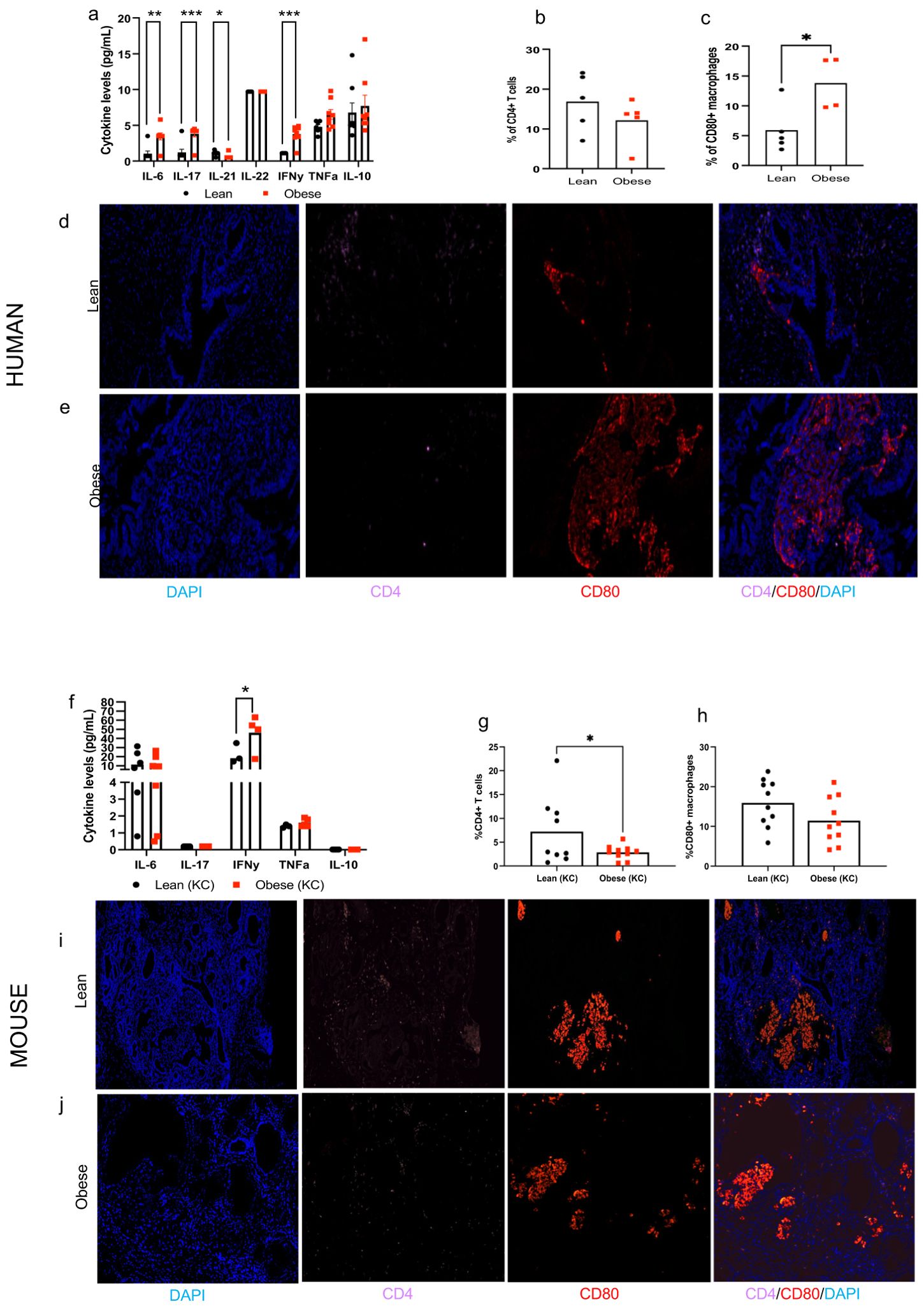 Graphs and immunofluorescence images comparing cytokine levels and immune cell markers in lean and obese subjects, both human and mouse. Charts show cytokine levels and percentages of CD4+ T cells and CD80+ macrophages. Images illustrate tissue staining for CD4, CD80, and DAPI in lean and obese conditions.