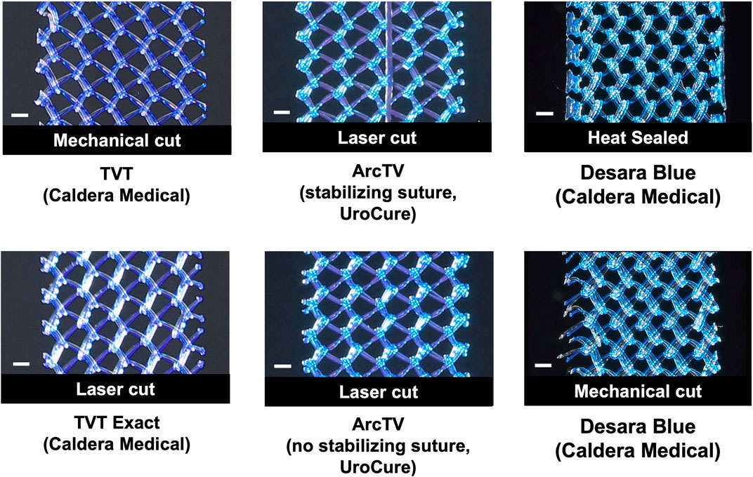 Six images depicting different types of medical devices (i.e., midurethral slings). Top row (left to right): TVT by Caldera Medical (mechanical cut), ArcTV with stabilizing suture by UroCure (laser cut), Desara Blue by Caldera Medical (heat sealed). Bottom row (left to row): TVT Exact by Caldera Medical (laser cut), ArcTV without stabilizing suture by UroCure (laser cut), Desara Blue by Caldera Medical (mechanical cut). Each mid-urethral sling appears in a close-up view showing intricate patterns.