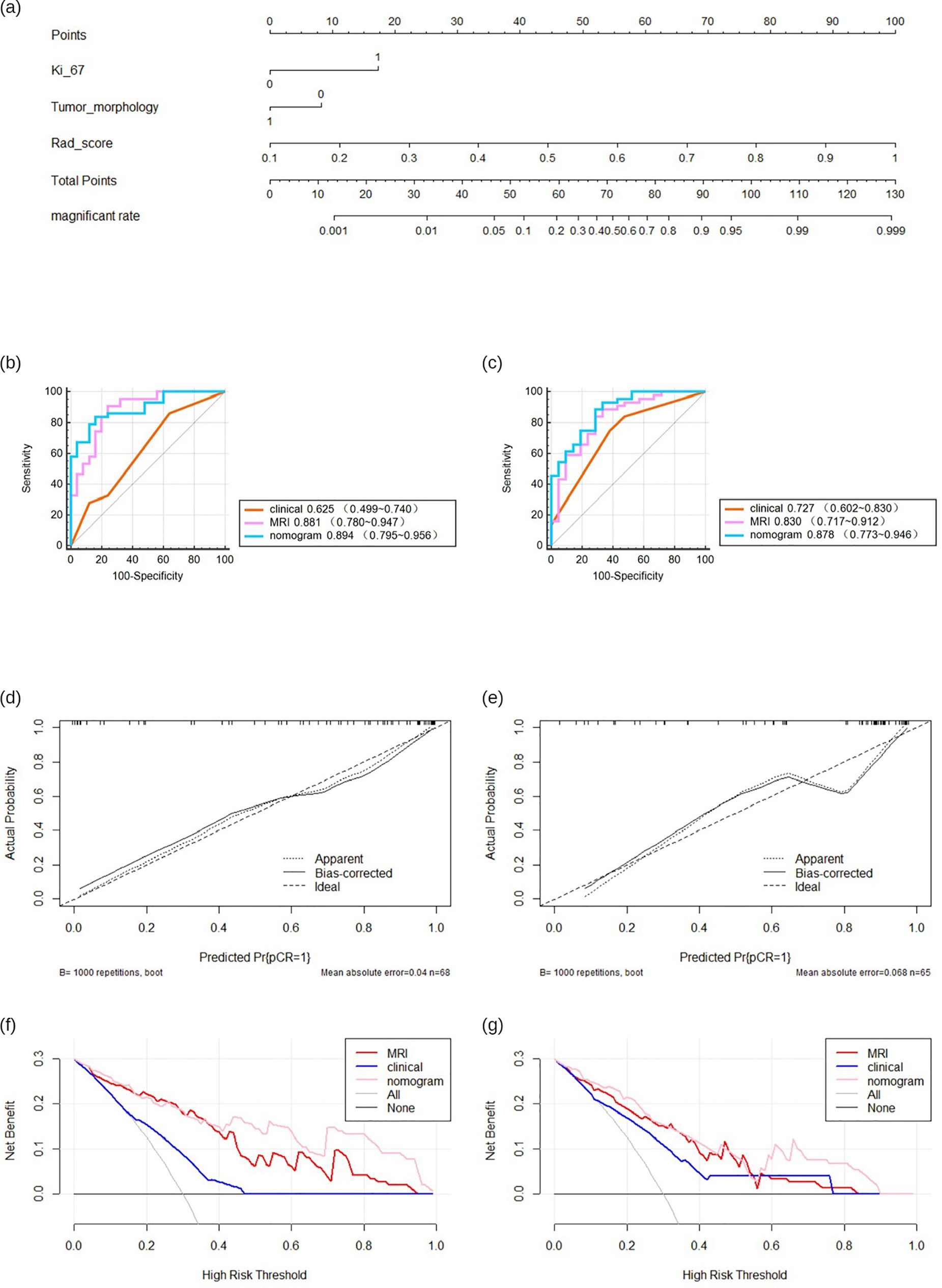 A series of medical data visualizations: (a) A nomogram for predicting magnification rate using points like KI_67, tumor morphology, and Rad_score. (b) and (c) ROC curves comparing clinical, MRI, and nomogram predictions with AUC values labeled. (d) and (e) Calibration plots showing apparent, bias-corrected, and ideal probabilities. (f) and (g) Decision curves for high risk threshold analysis, comparing clinical, MRI, nomogram, AI, and no intervention strategies, with a focus on net benefit.