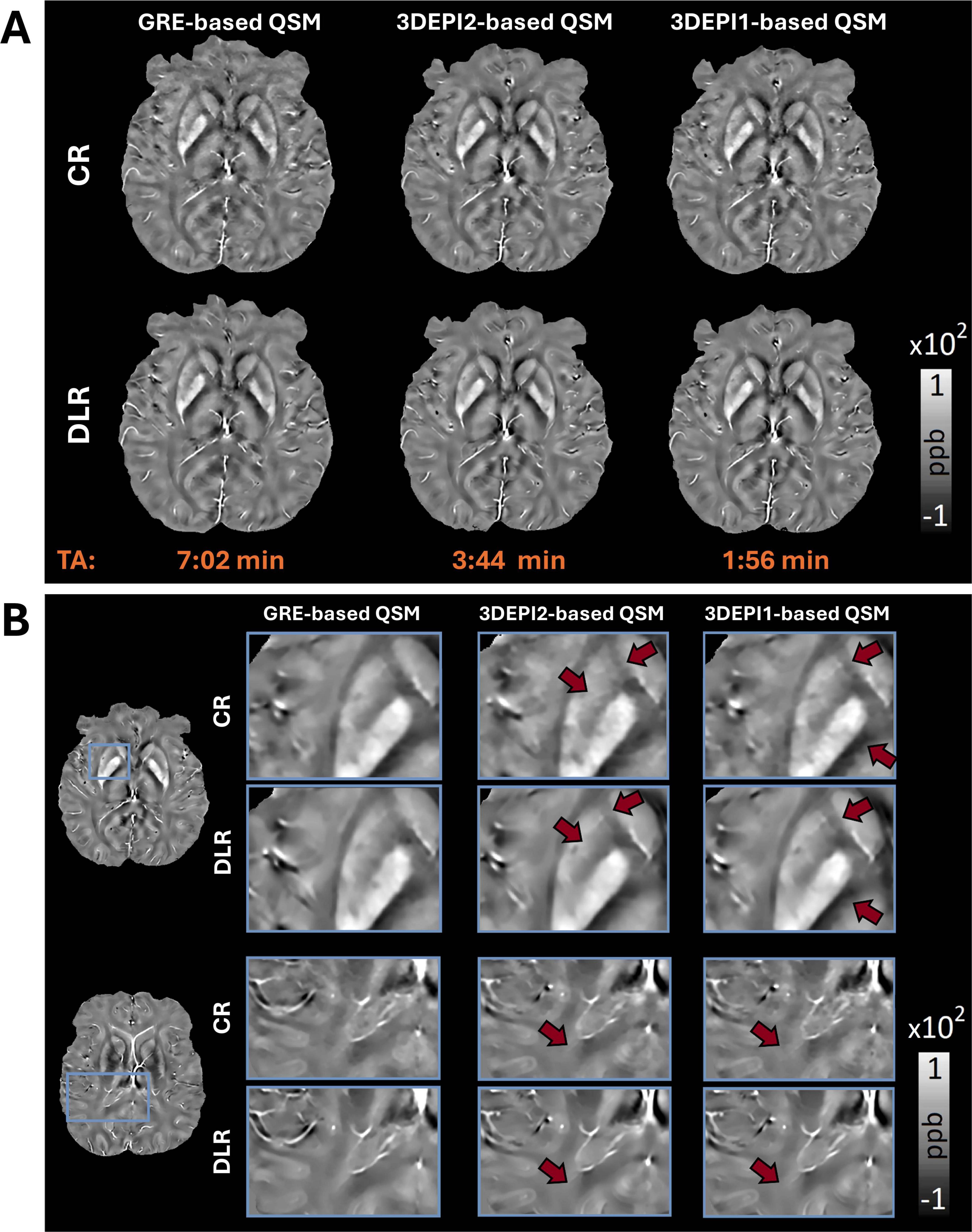 MRI brain scans comparing different quantitative susceptibility mapping (QSM) methods: GRE-based, 3DEPI2-based, and 3DEPI1-based. Panel A shows full brain images under CR and DLR conditions, with scan times noted. Panel B provides zoomed-in views highlighting structural differences with red arrows, under the same QSM methods and conditions. A grayscale color bar indicates intensity.