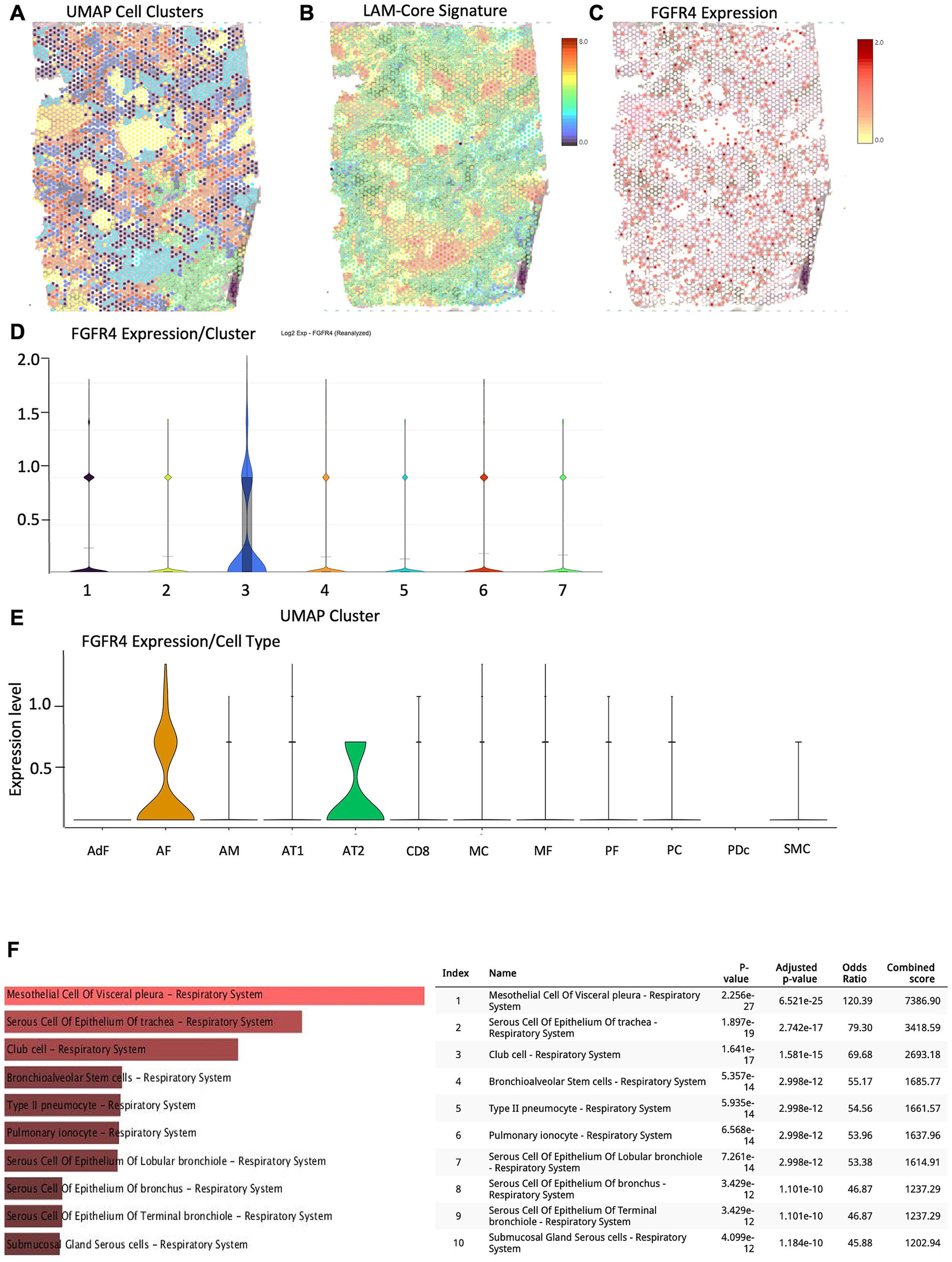 Panel showing UMAP analysis and expression data of FGFR4. (A) UMAP cell clusters with various colors. (B) LAM-Core signature with a color gradient from black to red. (C) FGFR4 expression depicted in red tone gradient. (D) Violin plot showing FGFR4 expression across seven UMAP clusters, highlighting peak expression in cluster three. (E) Violin plot displaying FGFR4 expression levels across different cell types, notable expression in AF and AT2 cells. (F) Table listing cell types related to the respiratory system with indices, names, and statistical values including p-values and combined scores.