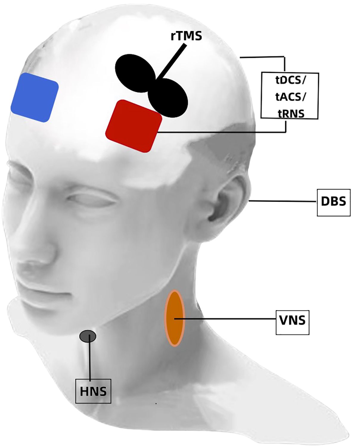 Diagram of a head with labels for different neurostimulation techniques. “rTMS” is shown on the scalp with black circles, “tDCS/tACS/tRNS” is marked on the forehead with colored squares, “DBS” is positioned at the base of the head, “HNS” on the lower neck, and “VNS” is highlighted on the side of the neck with an orange oval.