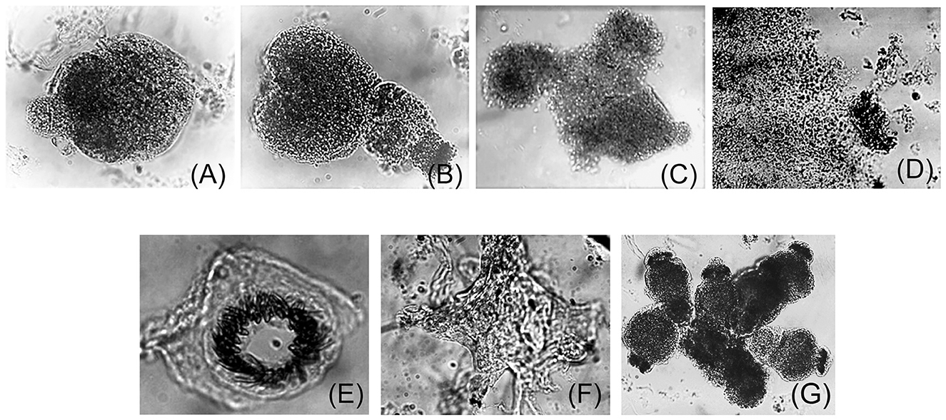 Seven microscopic images labeled A to G show various clusters of protoscolex with different shapes and densities. Images A, B, C, D, and G display dense, spherical or irregular cell protoscolex. Image E shows a circular released hook structure with a clearer center. Image F presents a spread-out arrangement with prominent elongated cell extensions.