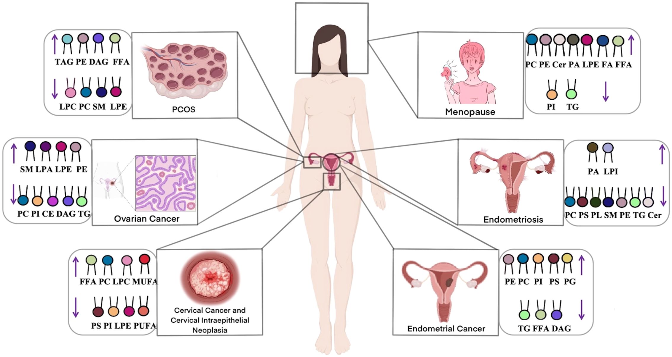 Illustration of the female reproductive system with conditions such as PCOS, menopause, ovarian cancer, endometriosis, cervical cancer, and endometrial cancer. Each condition highlights changes in lipid profiles, indicated by upward or downward arrows for various lipid types, including TAG, LPC, SM, LPE, and others.