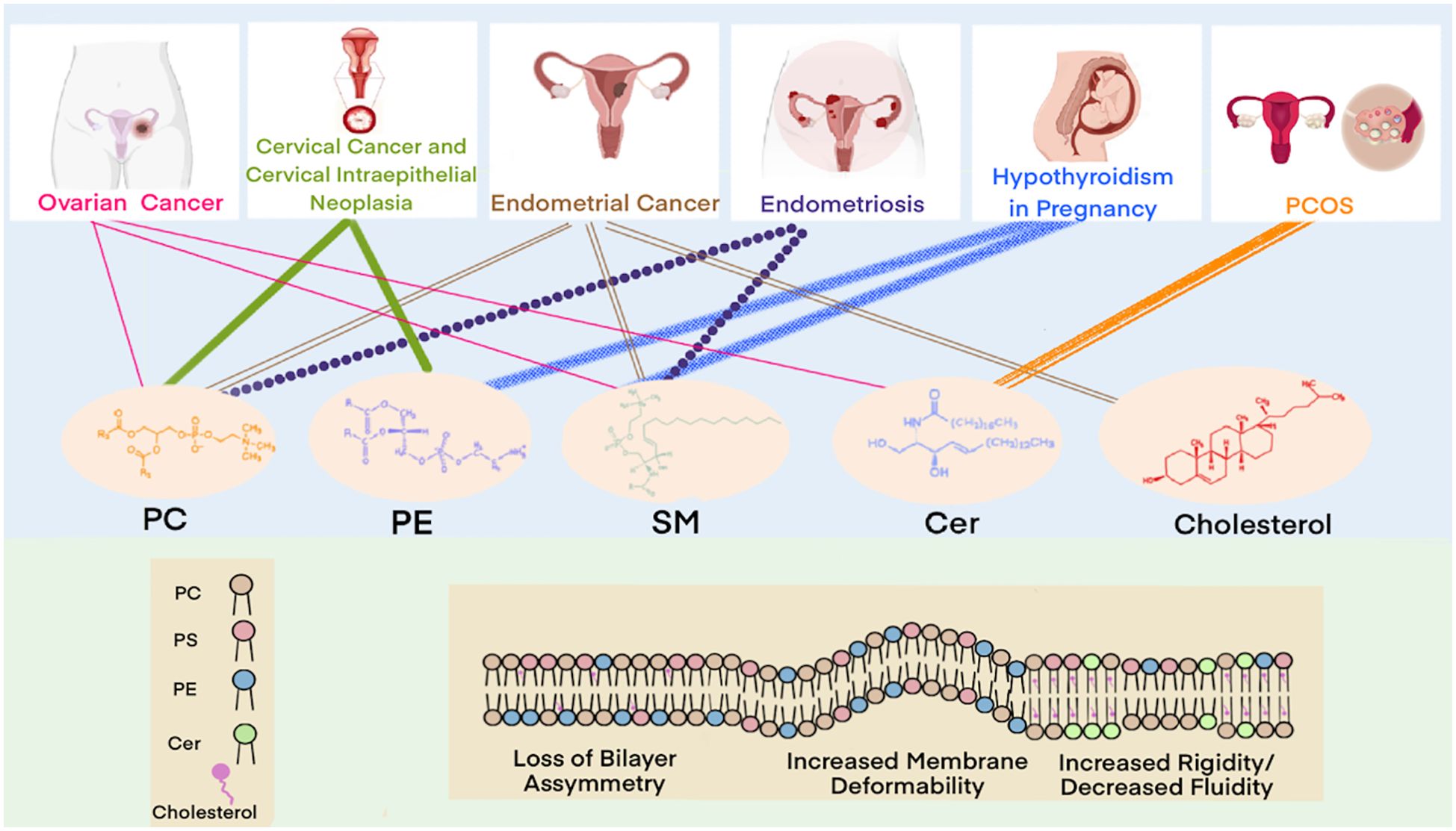 Graphic illustrating relationships between various gynecological and hormonal conditions with lipid components in cell membranes. Conditions include ovarian cancer, cervical cancer, endometrial cancer, endometriosis, hypothyroidism in pregnancy, and PCOS. Lipid components PC, PE, SM, Cer, and cholesterol are connected to these conditions with lines. A diagram below shows membrane changes: loss of bilayer asymmetry, increased membrane deformability, and increased rigidity/decreased fluidity.