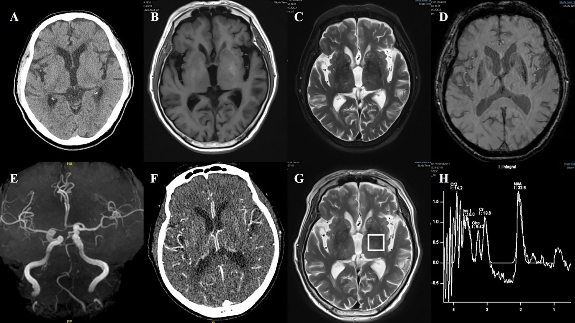 Several medical images are displayed: A, F are CT scans showing brain structure. B, D, G are MRI scans with various contrasts highlighting different brain tissues. C is an MRI with water content contrast. E is an MR angiogram depicting blood vessels. H is a graph showing spectroscopic analysis with peaks labeled for different metabolites.
