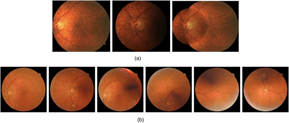 Two sets of retinal images labeled (a) and (b). Set (a) includes three retinal images, each showing varying visibility of the optic disc and retinal vessels. Set (b) contains six images displaying diverse retinal patterns, with noticeable variations in color and shading, highlighting the optic disc and vessel distribution.