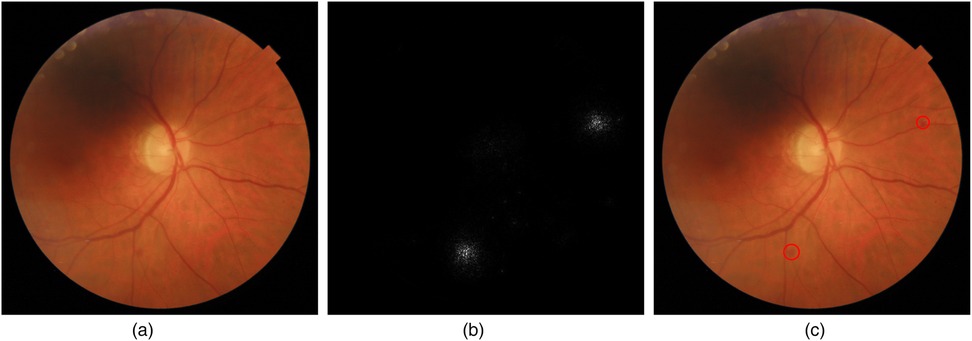Images show three panels of retinal scans. Panel (a) displays a retinal image with visible blood vessels radiating from the optic disc. Panel (b) presents a black and white fluorescence image highlighting specific areas. Panel (c) is similar to (a) with added red circles indicating areas of interest.