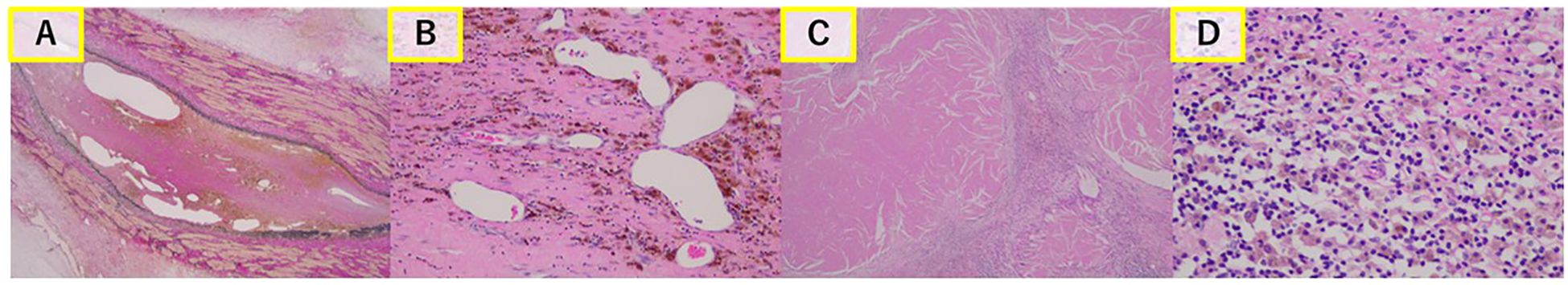 Histological image showing four panels labeled A to D. Panel A displays a layered structure with dense pink and purple hues. Panel B shows a more scattered texture with circular, empty spaces. Panel C features a fibrous pattern with lighter shading. Panel D illustrates a densely packed, granular texture with numerous dark spots.