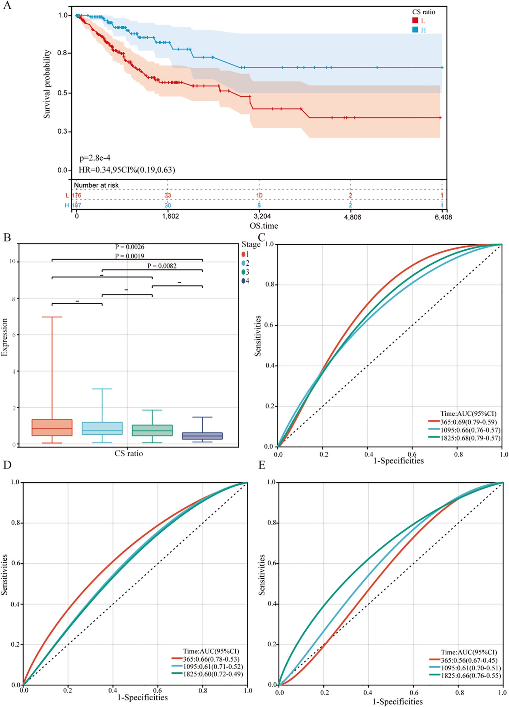 Panel A shows a Kaplan-Meier survival curve comparing low and high CS ratios, with significant differences in survival probability. Panel B displays a box plot of CS ratio expression across four stages, highlighting significant p-values. Panels C, D, and E present ROC curves with AUC values for different times, showing variations in sensitivity and specificity at one, three, and five-year intervals.