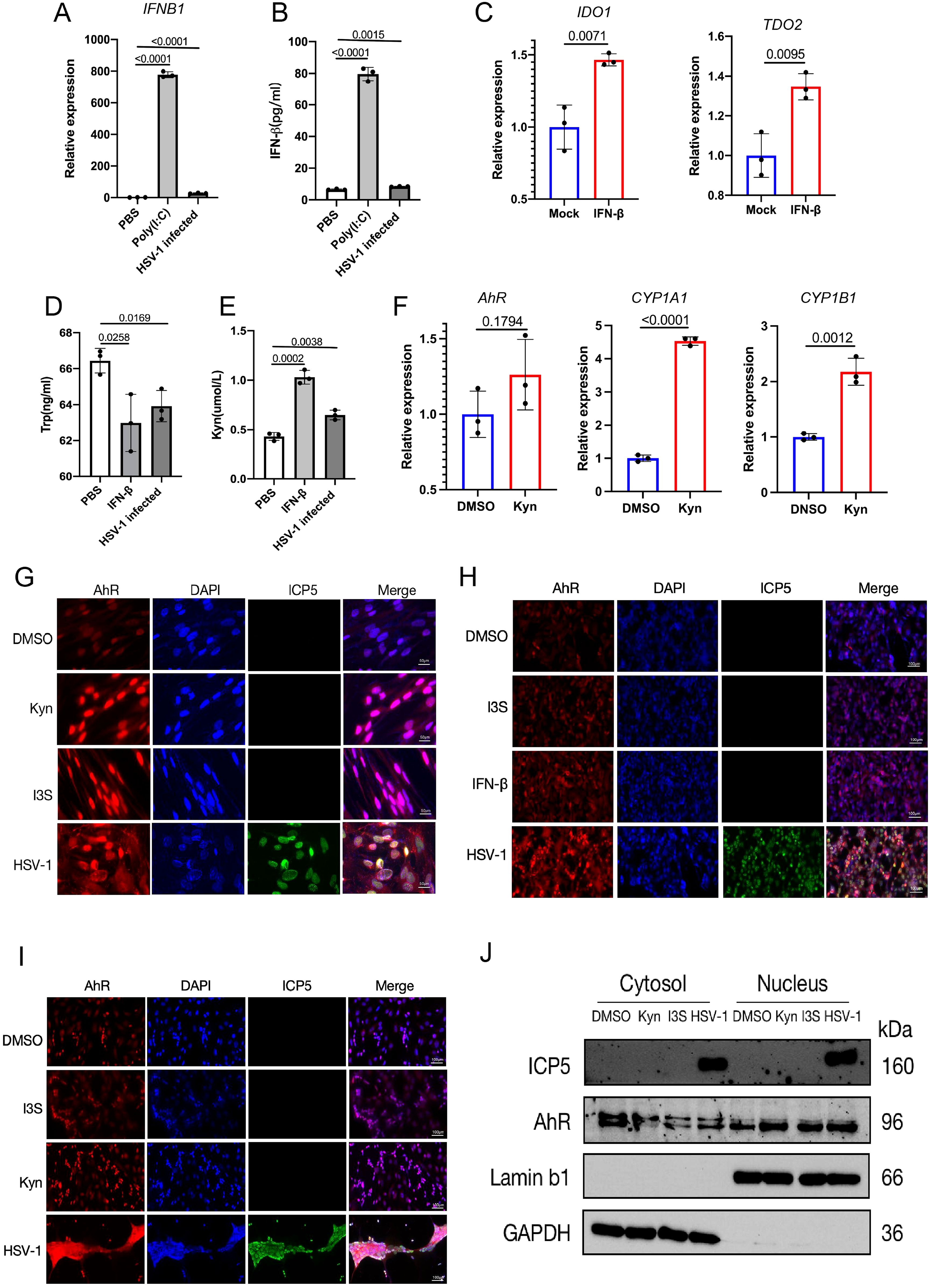 Bar graphs and images demonstrate the effects of HSV-1 infection, PBS, Poly(I:C), and IFN-b on various gene expressions and protein localizations. Panels A-F show relative expression levels of IFNB1, IFN-b, IDO1, TDO2, Trp, Kyn, AhR, CYP1A1, and CYP1B1 under different treatments with statistical signiļ¬cance indicated. Panels G-I feature immunoļ¬uorescent staining for AhR, DAPI, and ICP5 under various conditions. Panel J is a Western blot analysis displaying protein levels of ICP5, AhR, Lamin b1, and GAPDH in cytosolic and nuclear fractions under different treatments.