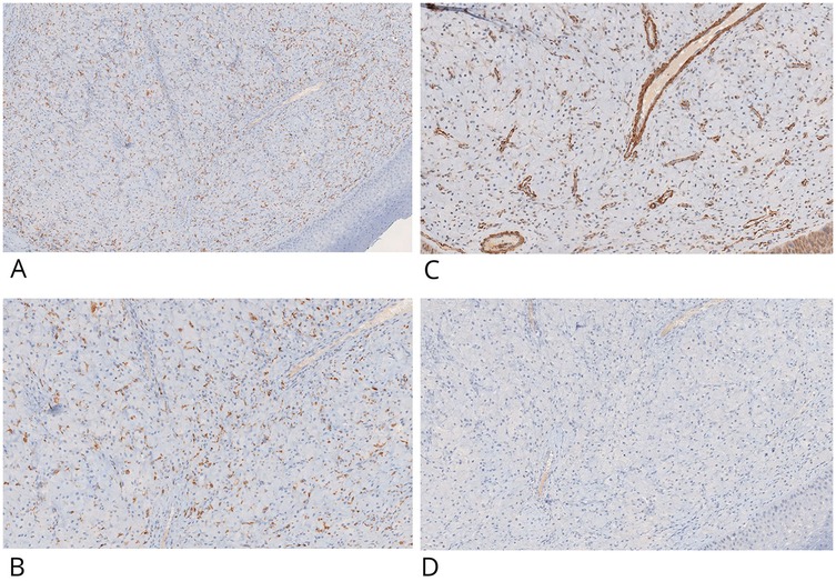 Four panels labeled A, B, C, and D show microscopic images of tissue samples stained in blue and brown. Panel A shows a moderately dense cluster of brown staining. Panel B exhibits a similar pattern but with slightly more dispersed staining. Panel C reveals prominent brown staining with distinct, elongated structures. Panel D displays minimal brown staining, primarily blue background with scattered cells.