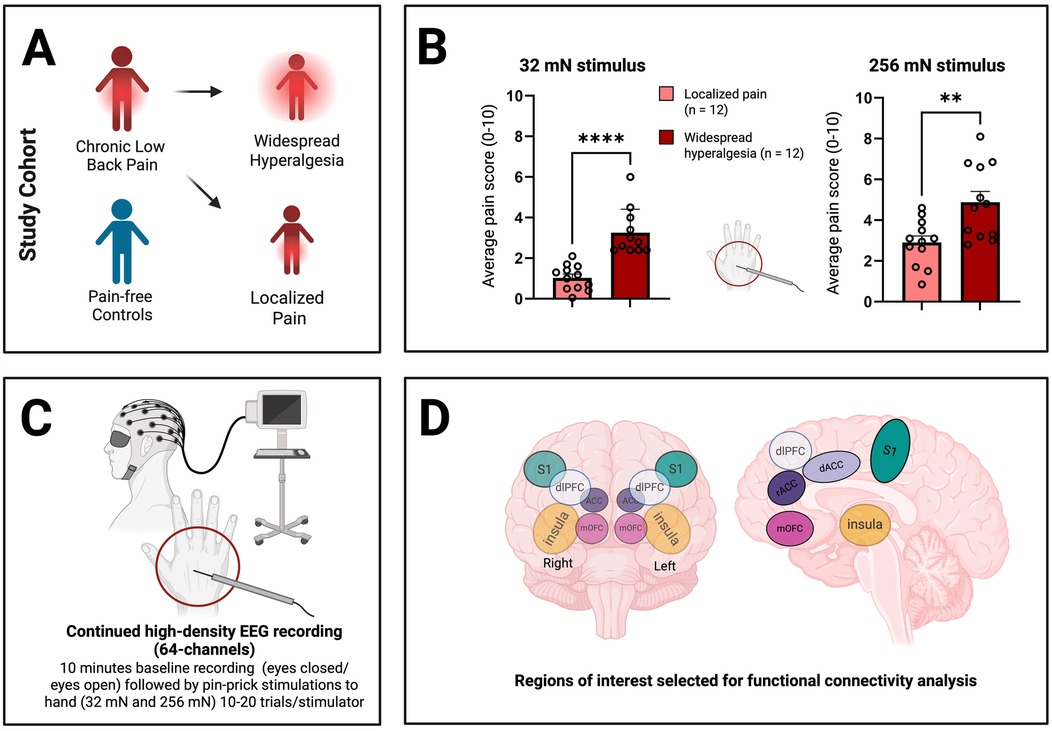 Panel A shows two groups in a pain study: chronic low back pain patients with either widespread hyperalgesia or localized pain, and pain-free controls. Panel B presents bar graphs comparing average pain scores from localized pain and widespread hyperalgesia groups in response to 32 millinewton and 256 millinewton stimuli, showing significantly higher pain in the widespread hyperalgesia group. Panel C depicts high-density EEG recording during pin-prick stimulation to the hand, indicating experimental setup. Panel D illustrates brain diagrams highlighting regions of interest for functional connectivity analysis, including bilateral S1, insula, dlPFC, rACC, dACC, and mOFC.