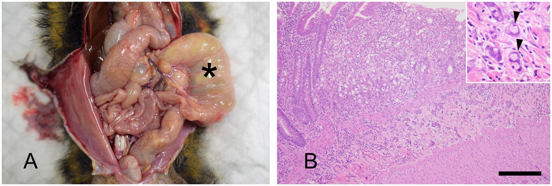 Image A shows a necropsy photograph of a marmoset with dilated small intestine marked by an asterisk. Image B shows a histological section of intestinal adenocarcinoma with signet ring cell features, stained in pink and purple. The inset highlights tumor cells with cytoplasmic vacuolation displacing the nuclei, indicated by arrowheads.