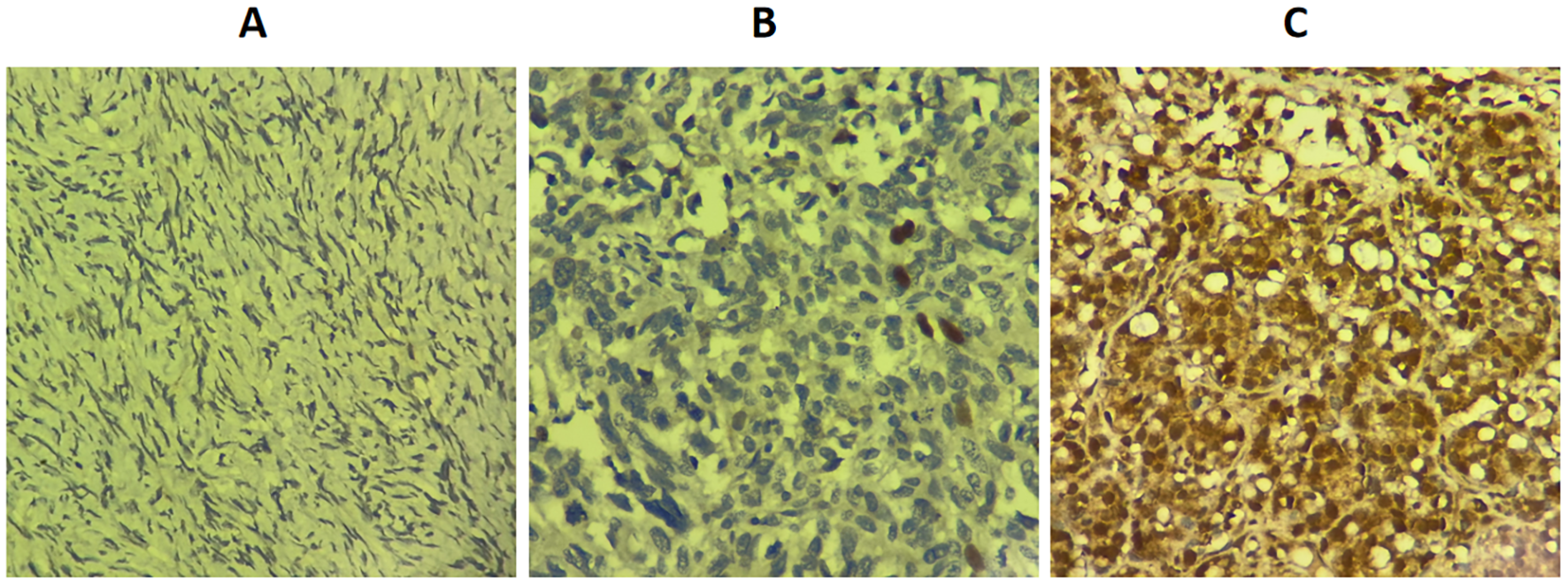 Three microscopic images labeled A, B, and C display different tissue samples. Image A shows a pattern of elongated spindle-shaped cells. Image B displays a dense cluster of rounder and elliptical cells. Image C reveals a network of cells with distinct gaps and darker staining, indicating varying levels of activity or density.