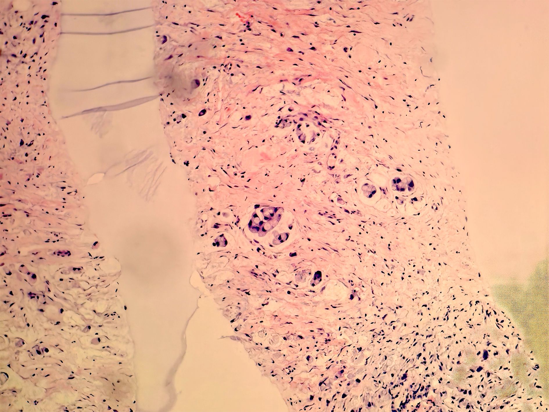 Microscopic view of human connective tissue with spindle-shaped fibroblast cells scattered among a matrix of collagen fibers. The nuclei of the fibroblasts are visible as dark spots. The tissue shows a wavy, fibrous appearance with light pink staining highlighting cellular structures.
