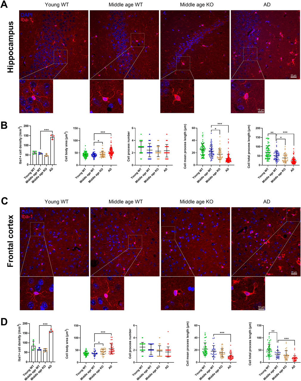 Panel A shows hippocampus images for different groups: Young WT, Middle age WT, Middle age KO, and AD. Microglia (Iba-1 in red) and nuclei (DAPI in blue) are visible. Panel B presents graphs of histological measurements and cell morphology. Panel C shows frontal cortex images with similar staining and layout as panel A. Panel D offers corresponding graphs for the frontal cortex, showing Iba-1+ cell density, cell body area, cell process number, and length. Statistical significance is indicated in graphs.