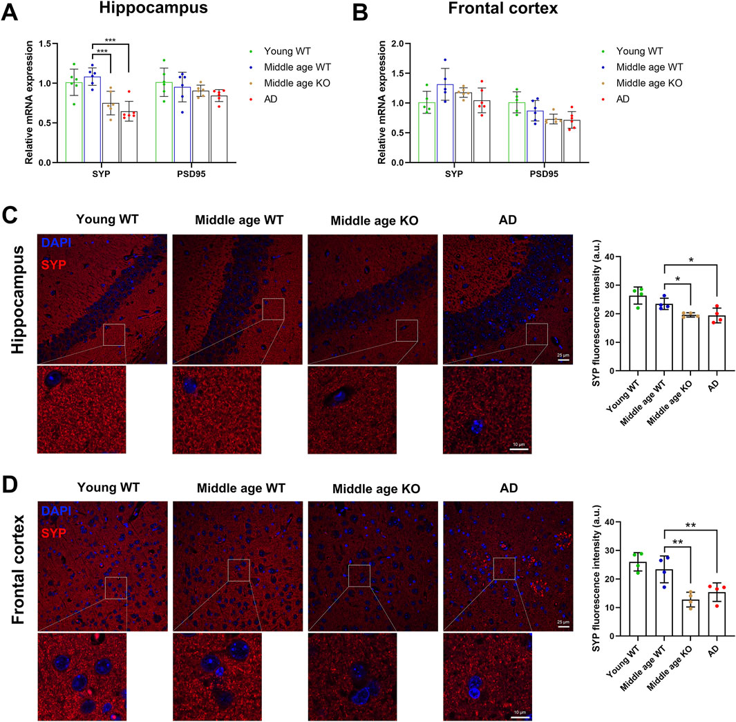 Graphs and fluorescent images show data on synaptic markers SYP and PSD95 in the hippocampus and frontal cortex. A and B: Bar graphs compare mRNA expression among Young WT, Middle Age WT, Middle Age KO, and AD groups, with statistical significance indicated. C and D: Fluorescent images for DAPI and SYP in different age groups with corresponding fluorescence intensity graphs, highlighting variations and statistical significance among groups.