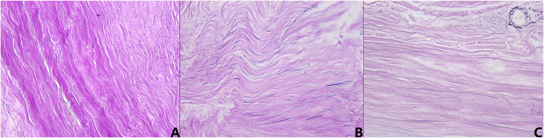 Three panels labeled A, B, and C show microscope images of tissue samples stained in varying shades of purple. Panel A displays densely packed wavy fibers, panel B shows slightly looser wavy structures, and panel C has even more sparse, wavy patterns with visible darker outlines.