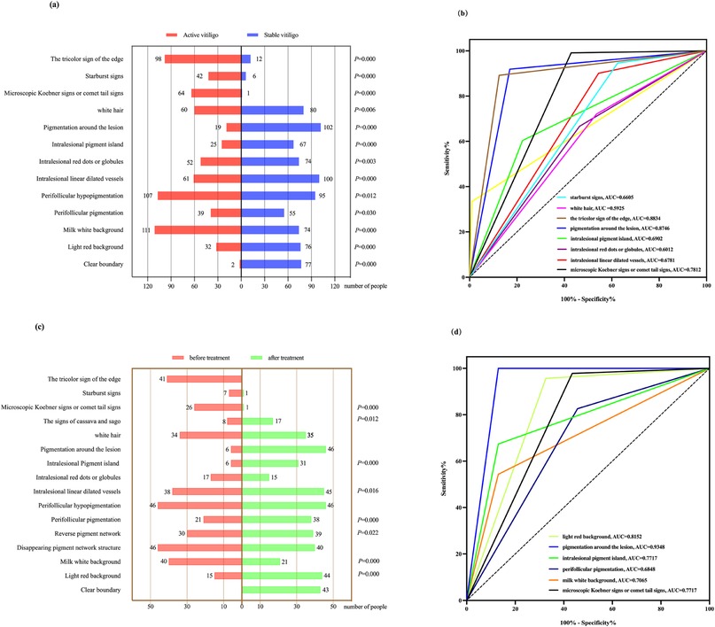 Four-panel image displaying data on vitiligo signs and treatment. Panel (a) shows a bar chart comparing active and stable vitiligo with various skin signs. Panel (b) presents a ROC curve assessing specificity and sensitivity for different vitiligo features. Panel (c) includes a bar chart comparing signs before and after treatment. Panel (d) exhibits a ROC curve evaluating treatment effects on specificity and sensitivity, detailing different signs’ performance metrics.