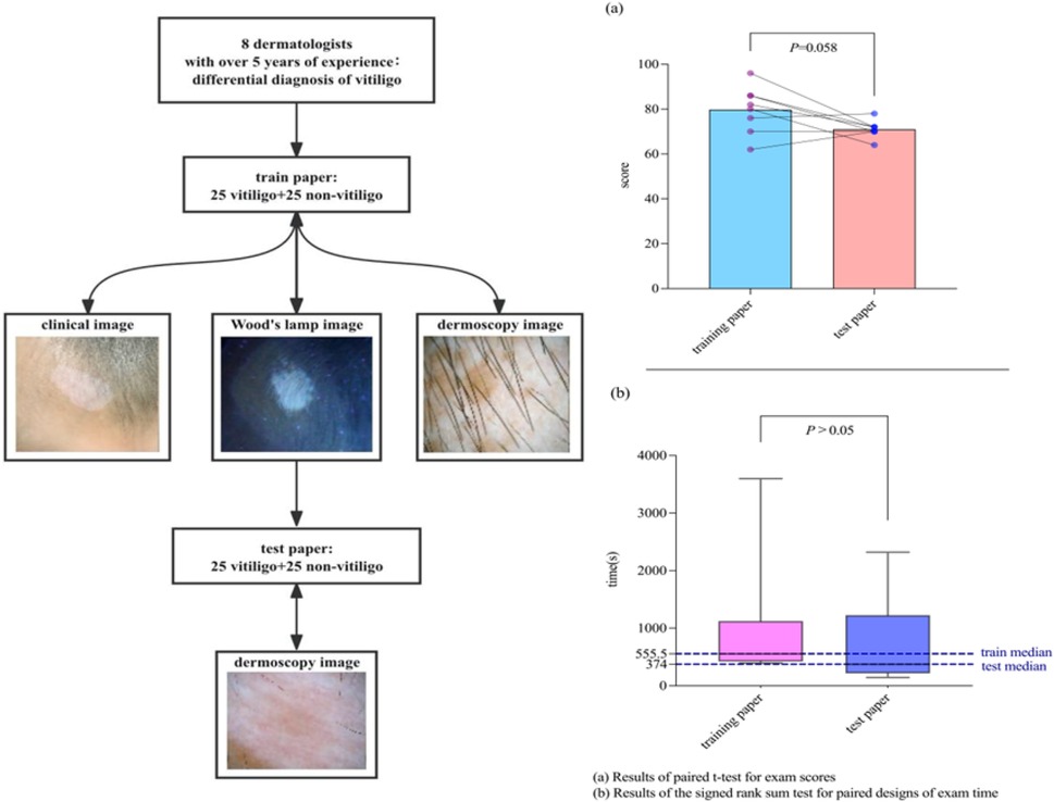 Flowchart showing a study where 8 dermatologists diagnose vitiligo using clinical, Wood’s lamp, and dermoscopy images. Two graphs show results: (a) Bar graph comparing scores for training and test papers with p-value of 0.058, (b) Box plot comparing exam time with p-value greater than 0.05. Training and test papers consist of 25 images each of vitiligo and non-vitiligo cases.