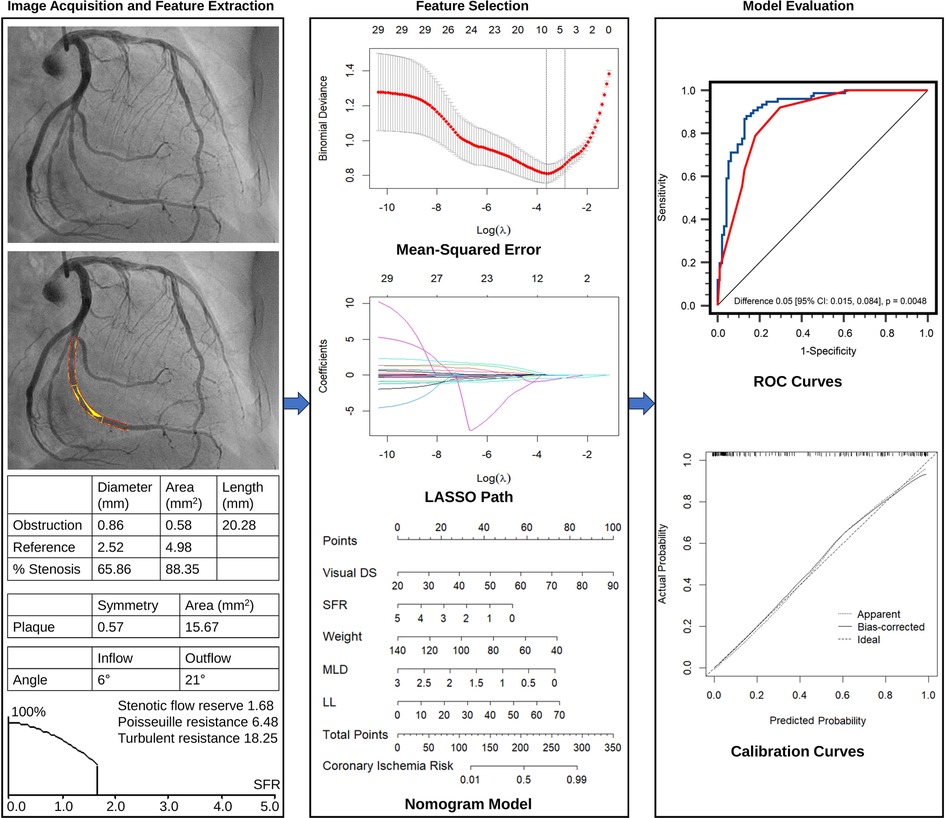 Coronary artery angiography images show obstruction analysis with computed parameters like diameter, area, and length. Feature selection uses graphs of mean-squared error and LASSO path. Model evaluation includes ROC and calibration curves. A nomogram model predicts coronary ischemia risk based on various clinical measurements.