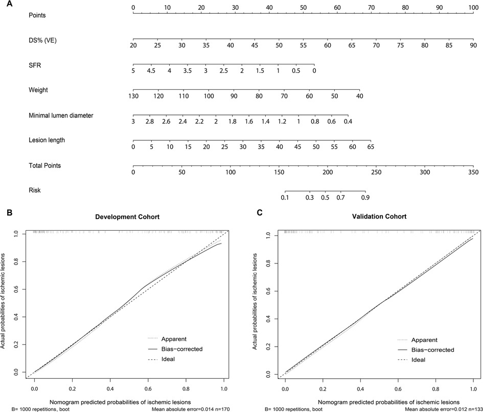 Panel A shows a nomogram with scales for points, DS% (VE), SFR, weight, minimal lumen diameter, lesion length, total points, and risk. Panel B and C display calibration plots for development and validation cohorts, respectively, comparing nomogram-predicted probabilities of ischemic lesions with actual probabilities. Solid, dashed, and dotted lines represent bias-corrected, apparent, and ideal probabilities. Panel B's mean absolute error is 0.014 and panel C's is 0.012.