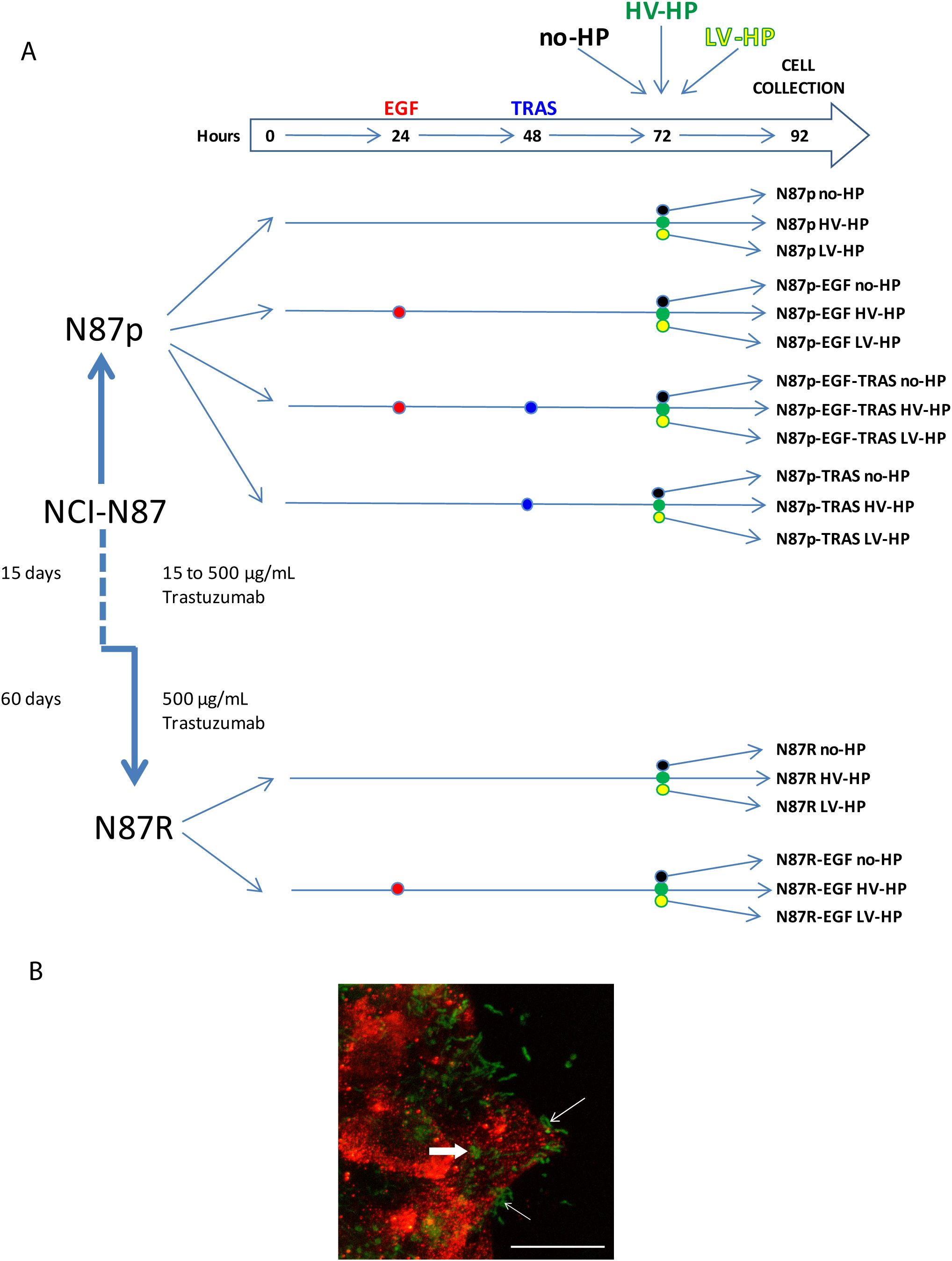 A diagram and micrograph related to a study on NCI-N87 celltreatment. Part A shows timelines and treatment pathways for the N87p and N87R celllines, detailing exposure to EGF,TRAS, and different pressure conditions (no-HP,HV-HP, LV-HP). Arrows indicate treatment steps over specified durations with trastuzumab. PartB shows a confocal micrograph with red and green staining, highlighting cellularstructures, and includes arrows pointing to specific features.