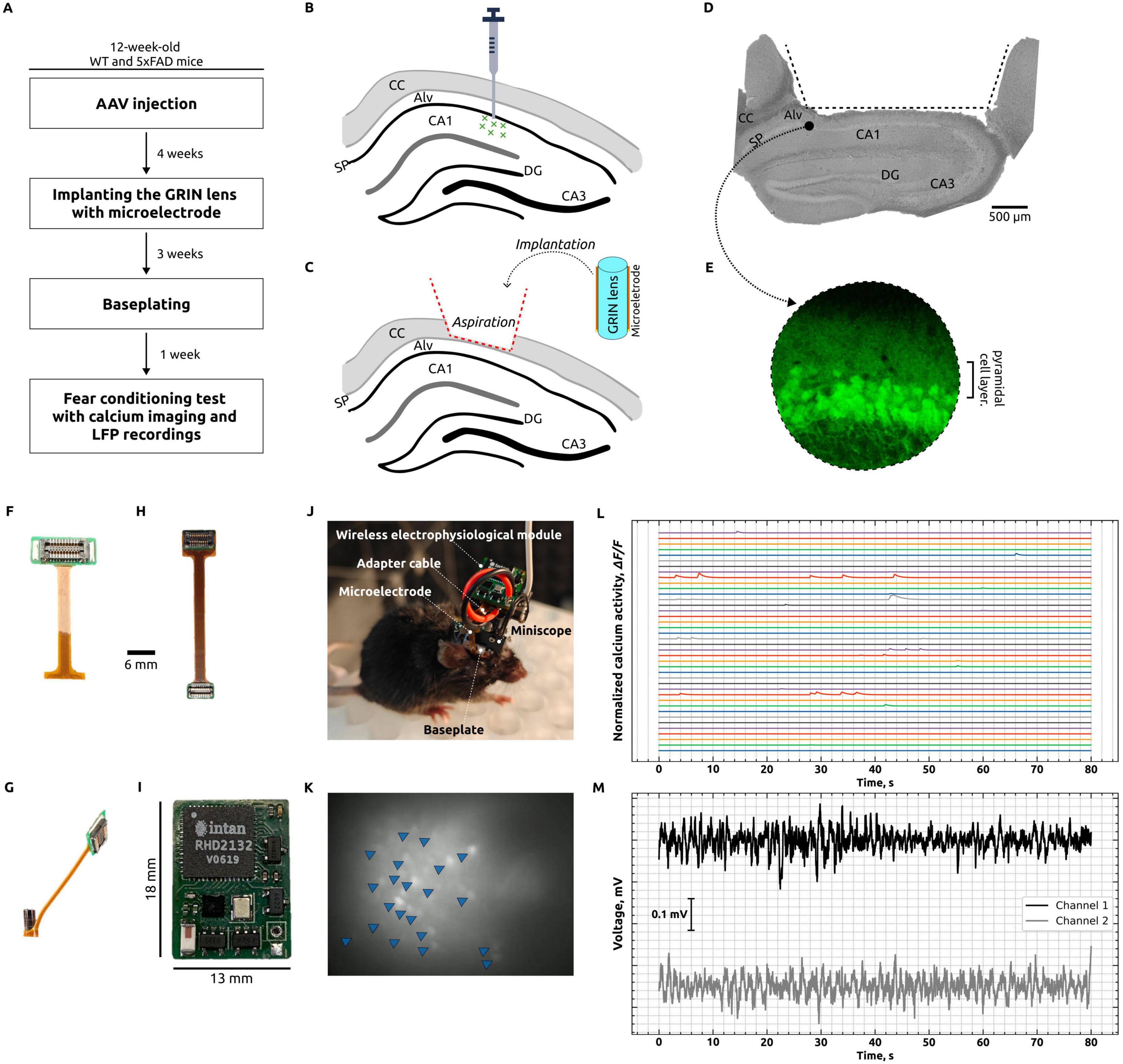 Flowchart of an experiment on 12-week-old mice showing steps: AAV injection, GRIN lens and microelectrode implantation, baseplating, and fear conditioning. Diagrams illustrate brain regions and implantation details. Images depict a mouse with equipment, GRIN lens, and a wireless electrophysiology module. Results include include graphs of calcium and electrophysiological activity.