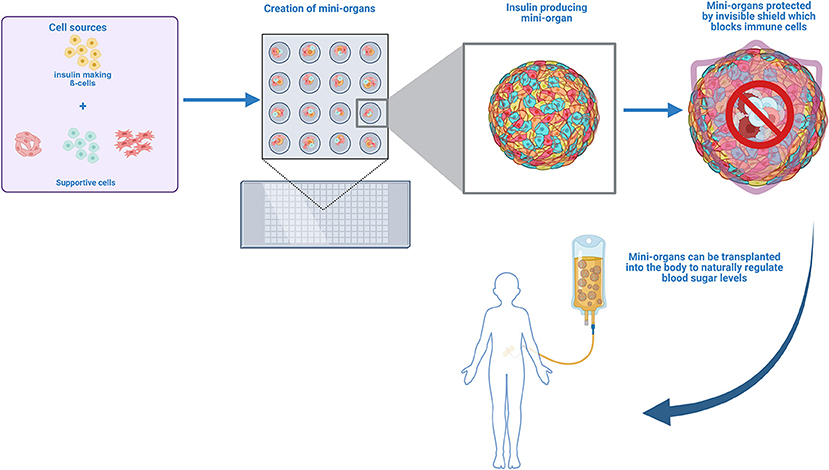 Diagram illustrating the development and transplantation of insulin-producing mini-organs. Cell sources, including insulin-making beta cells and supportive cells, are used to create mini-organs, depicted in cultures. These mini-organs are protected by a shield to block immune cells, preventing immune response. The final image shows a mini-organ being transplanted into a human to regulate blood sugar levels.