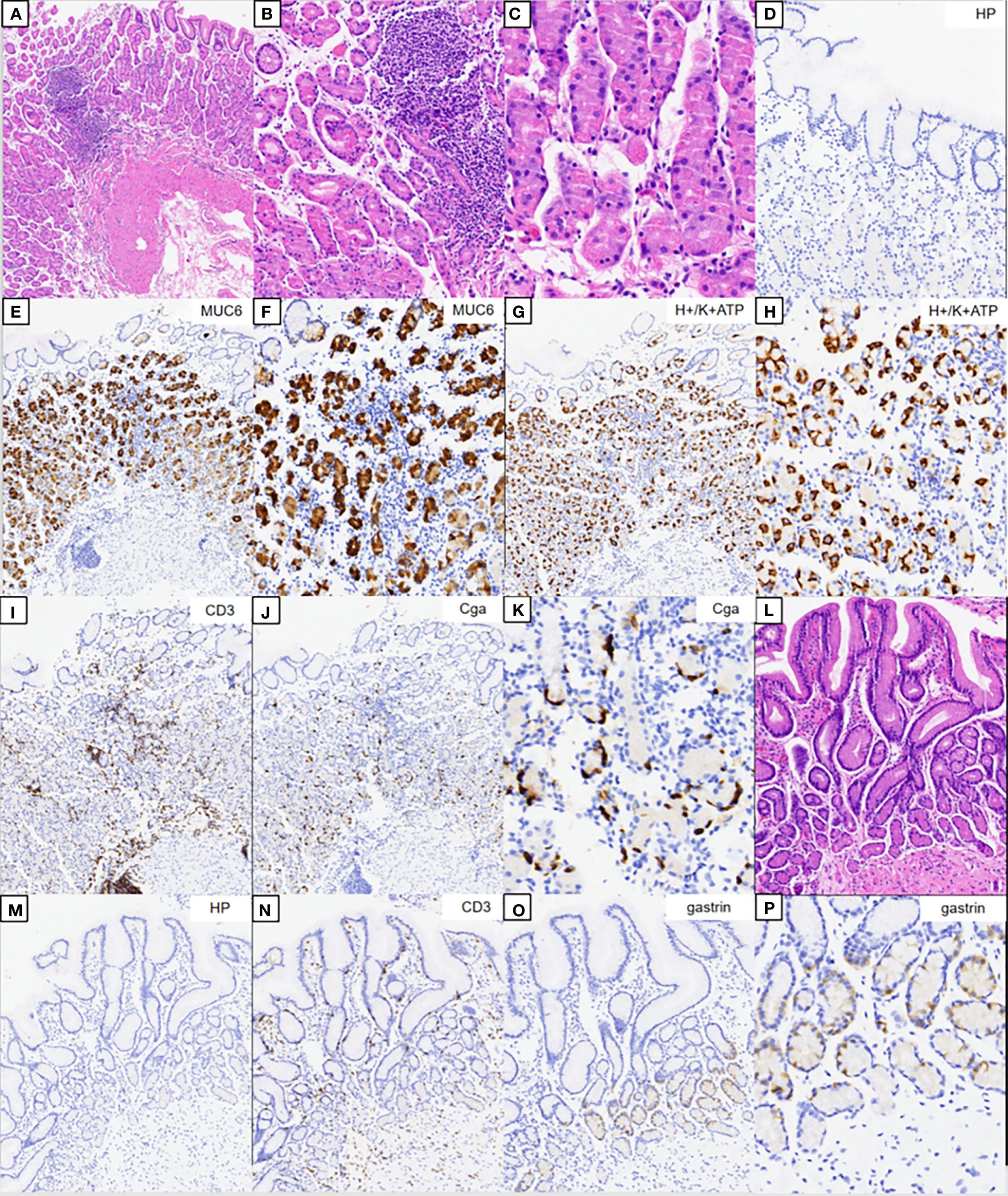 Histological and immunohistochemical images showing various staining patterns and tissue structures. Panels A, B, C, and L display hematoxylin and eosin staining. Panels E, F, G, H, I, J, K, M, N, O, and P show immunohistochemical staining with markers such as MUC6, H+/K+ ATPase, CD3, chromogranin A (Cga), and gastrin. Panel D and M are labeled HP. Different panels highlight cellular and tissue features, with varying staining intensities indicating different protein expressions.