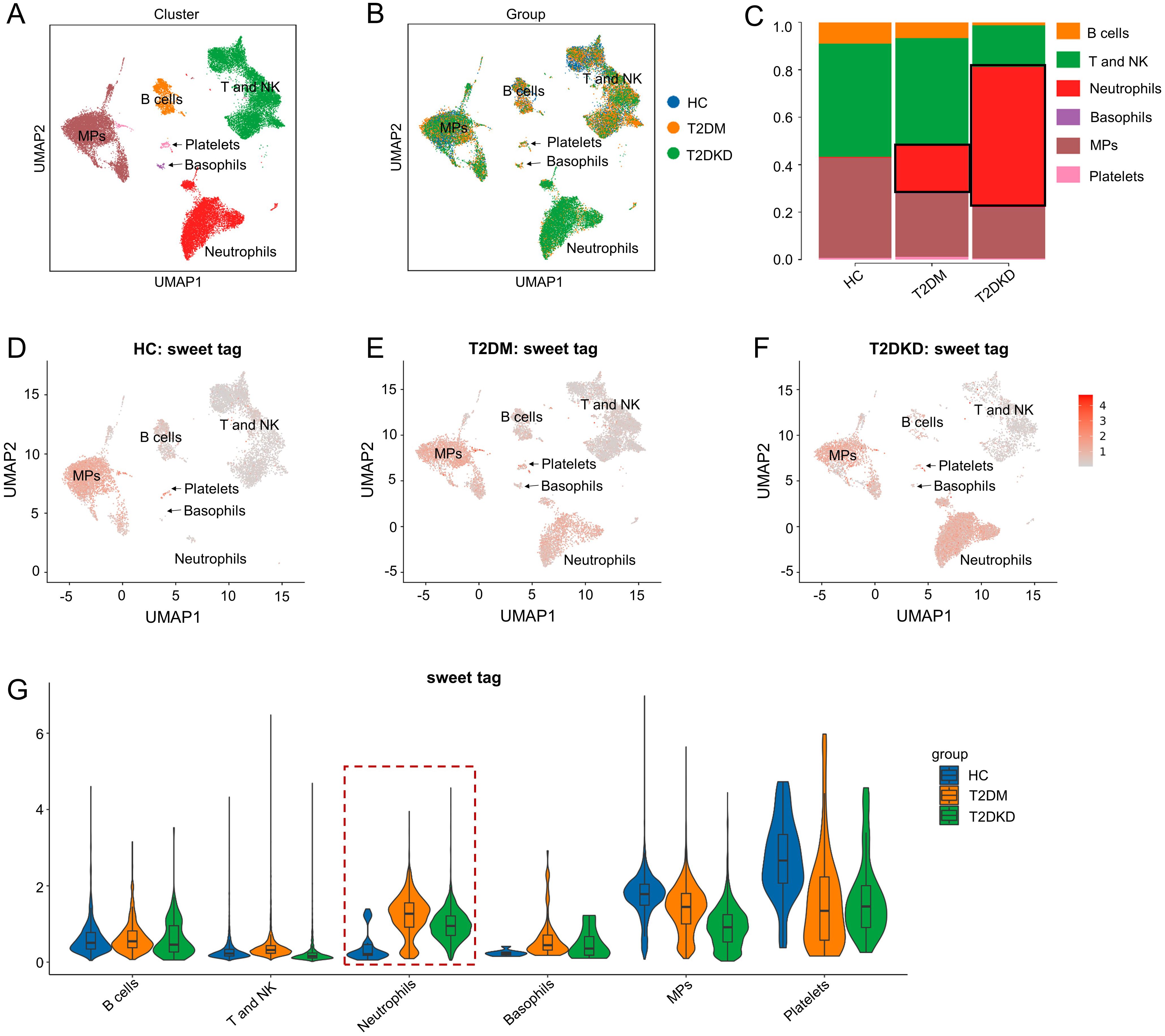 Graphical analysis of cell types across different groups: (A) and (B) show UMAP plots of cell clusters and groups including B cells, T and NK cells, neutrophils, basophils, MPs, and platelets. (C) is a stacked bar chart showing cell type distribution across HC, T2DM, and T2DKD groups. (D), (E), and (F) are UMAP plots displaying cell type distribution labeled with “sweet tag” in HC, T2DM, and T2DKD groups, respectively. (G) depicts violin plots of cell type expression levels for the three groups. Group colors: HC in blue, T2DM in orange, and T2DKD in green.