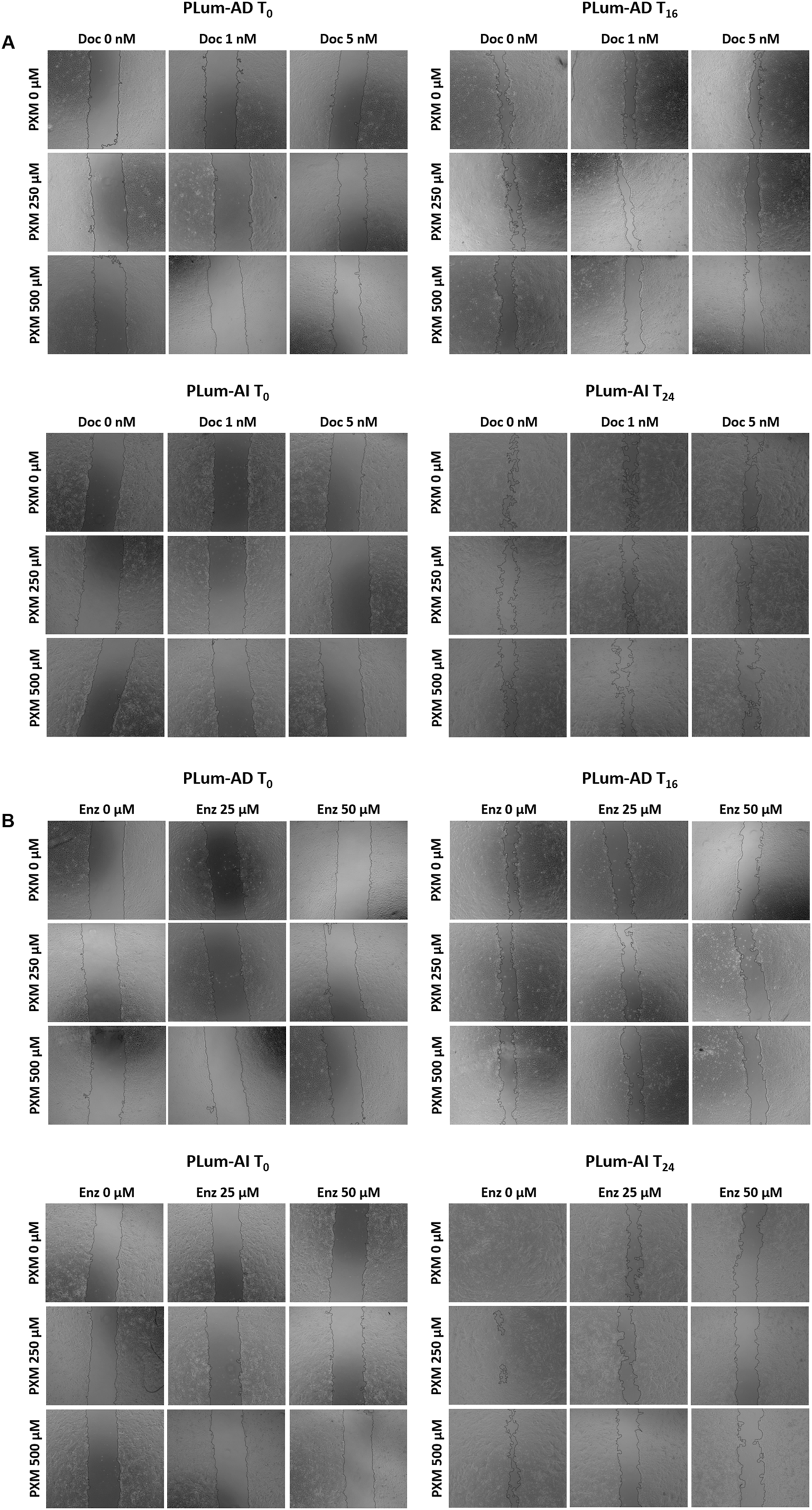 Microscopic images showing cell migration assays with different treatments over time. Rows represent varying concentrations of PXM, while columns show different concentrations of Doc or Enz at times T0, T16, and T24. The images illustrate the effects of these variables on cell movement.