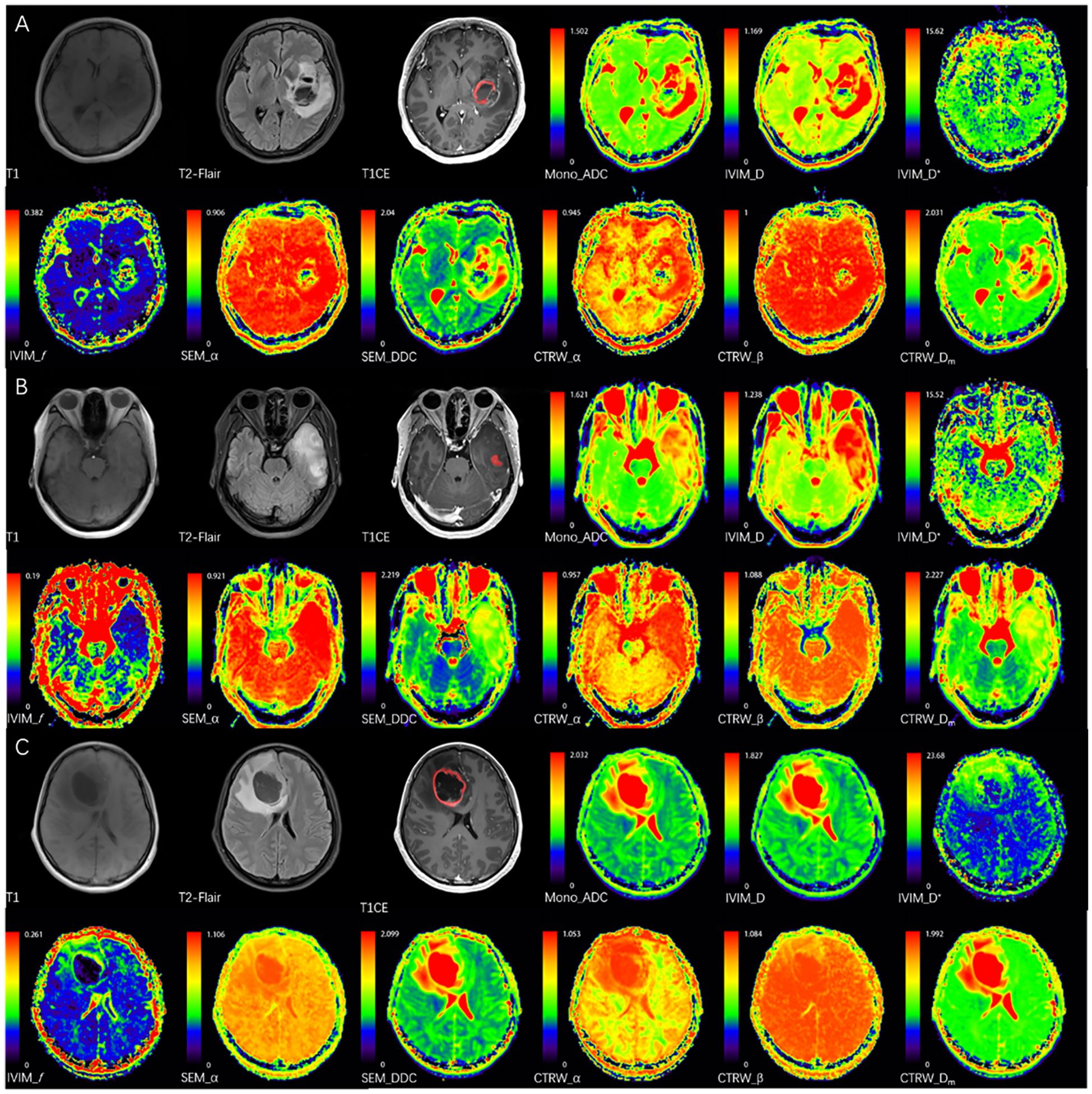 MRI scans classified into three rows labeled A, B, and C. Each row features multiple brain images with different imaging techniques, indicated by labels such as T1, T2-Flair, T1CE, Mono_ADC, and others. Color maps range from blue to red, showing variations in brain activity or structure.