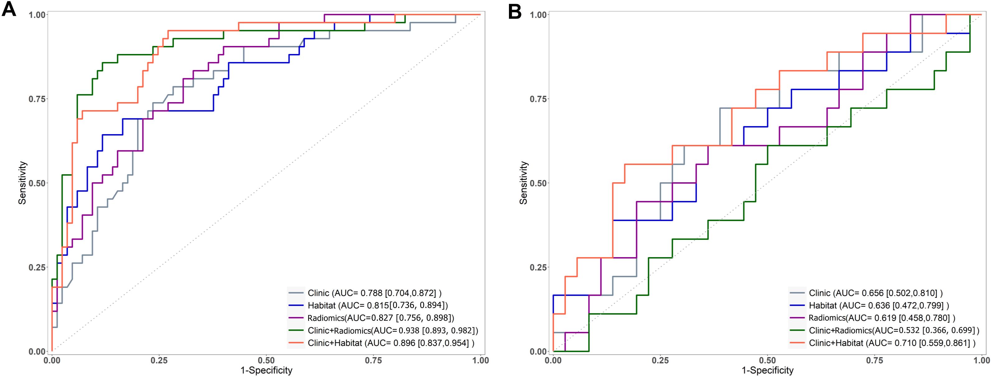 Two receiver operating characteristic (ROC) curves labeled A and B compare diagnostic models. Curve A shows higher sensitivity with better performance; Clinic+Radiomics (green) has the highest AUC of 0.938, followed by Clinic+Habitat (red) at 0.896. Curve B presents lower sensitivity; Clinic+Habitat has the highest AUC of 0.710. The legend details AUC values for each model, illustrating comparative accuracies.
