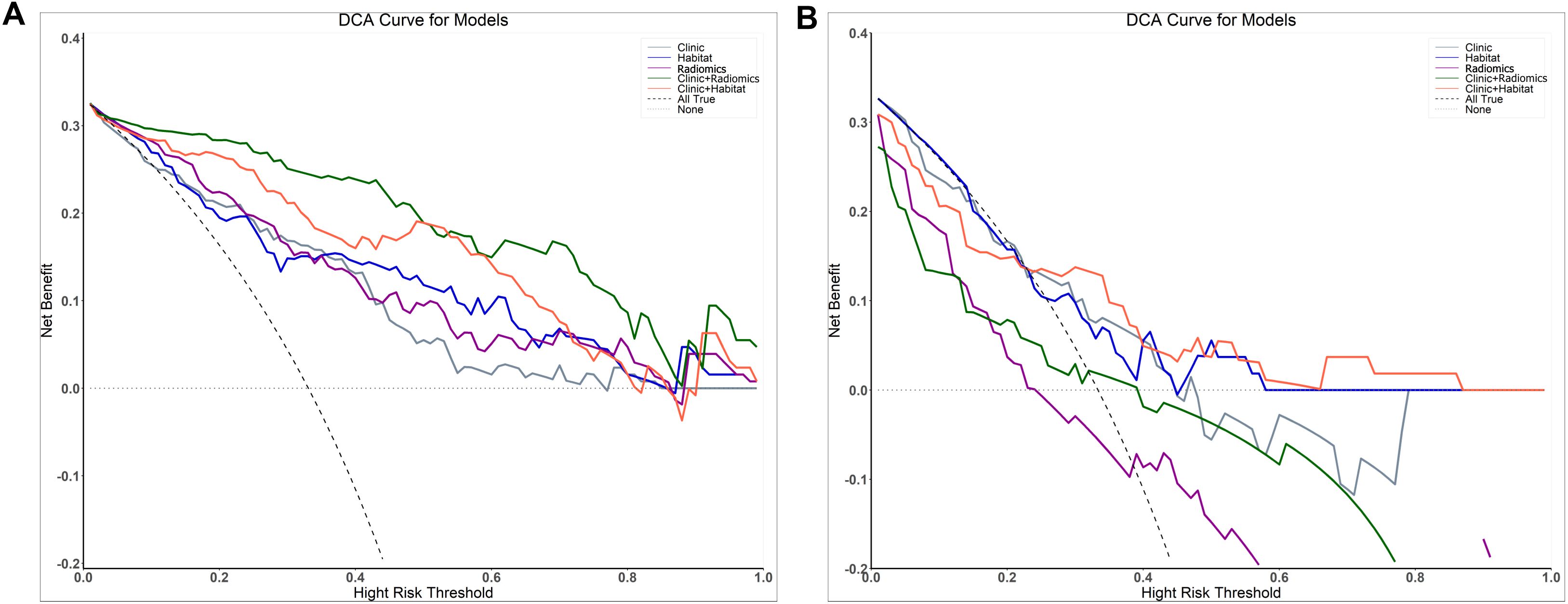 Panel A and B show Decision Curve Analysis (DCA) graphs comparing models named Clinic, Habitat, Radiomics, Clinic+Radiomics, Clinic+Habitat, with curves for “All True” and “None”. The y-axis represents net benefit, and the x-axis is the high-risk threshold. Each model's performance varies across thresholds.