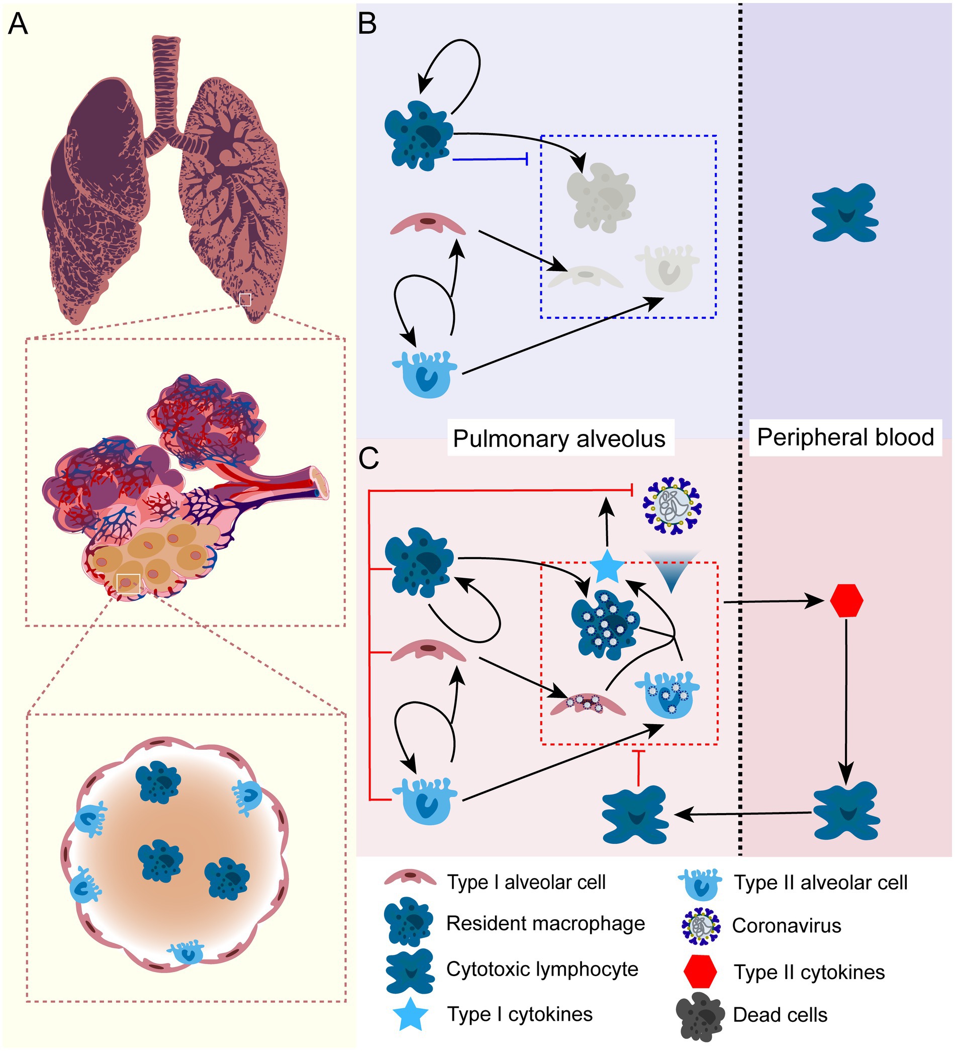Diagram illustrating the interaction of various cells and coronavirus in pulmonary alveoli and peripheral blood. Panel A shows a lung and detailed alveolar structure. Panel B depicts interactions in the pulmonary alveolus, highlighting resident macrophages, alveolar cells, and coronavirus. Panel C shows further interactions, including cytotoxic lymphocytes and cytokines, in alveoli and peripheral blood. Arrows indicate pathways and effects of cellular interactions, with labels identifying each cell type and component.