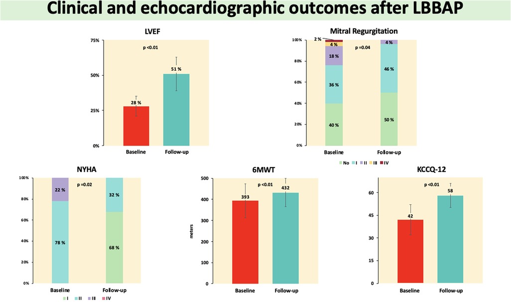 Bar graph illustrating clinical and echocardiographic outcomes after PABB. LVEF increased from 28% at baseline to 51% at follow-up, and a reduction in mitral regurgitation severity and improved functional class were also observed. The 6-minute walk distance (6MWT) increased from 393 to 432 meters. The KCCQ-12 score increased from 42 to 58. All of these differences were statistically significant.