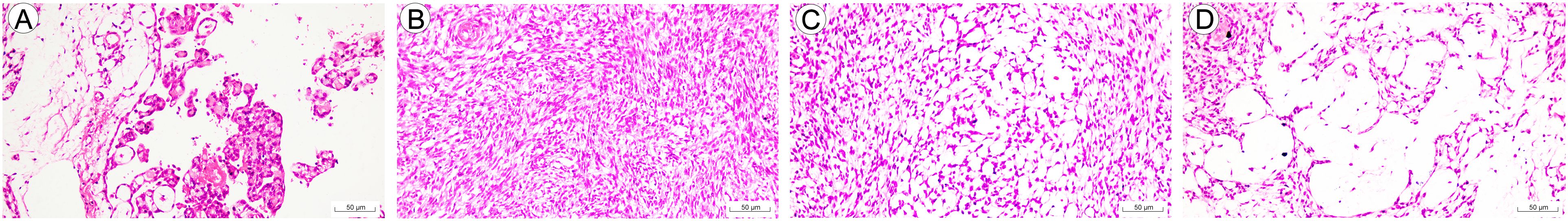 Microscopic images showing tissue samples stained with a pink dye. Panel A shows scattered cell clusters with clear spaces. Panel B displays a dense, fibrous tissue structure. Panel C reveals a more loosely arranged tissue with visible spaces between cells. Panel D highlights large, white adipocyte spaces within the tissue. Each panel includes a scale bar indicating fifty micrometers.