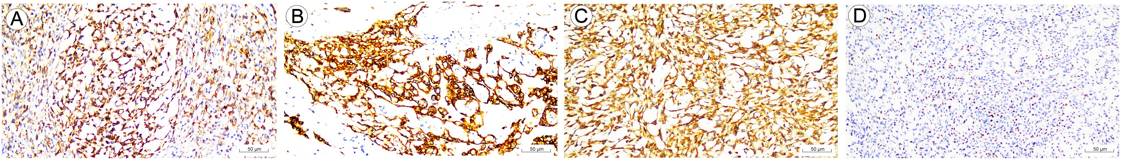 Histological panel showing four stained tissue samples labeled A through D. Sample A has moderate staining with irregularly shaped cells. Sample B shows dense, complex networks of darkly stained fibers. Sample C has uniform, strong staining with closely packed fibers. Sample D displays lighter staining with scattered small cells. Each section includes a scale bar indicating fifty micrometers.