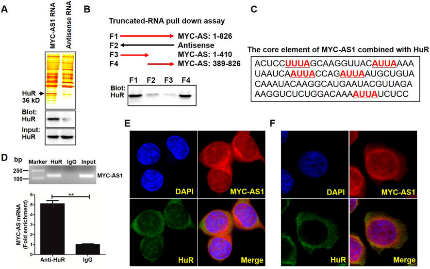 Research images depicting experiments on MYC-AS1 RNA interaction with HuR protein. A: Blot showing MYC-AS1 RNA binding to HuR. B: Truncated-RNA pull-down assay illustrating MYC-AS segments tested.C: Core element sequence of MYC-AS1 combined with HuR. D: Gel electrophoresis and bar graph indicating MYC-AS mRNA enrichment with anti-HuR and IgG controls. E and F: Fluorescent microscopy images showing MYC-AS1 and HuR colocalization in cell nuclei, with DAPI staining for reference.