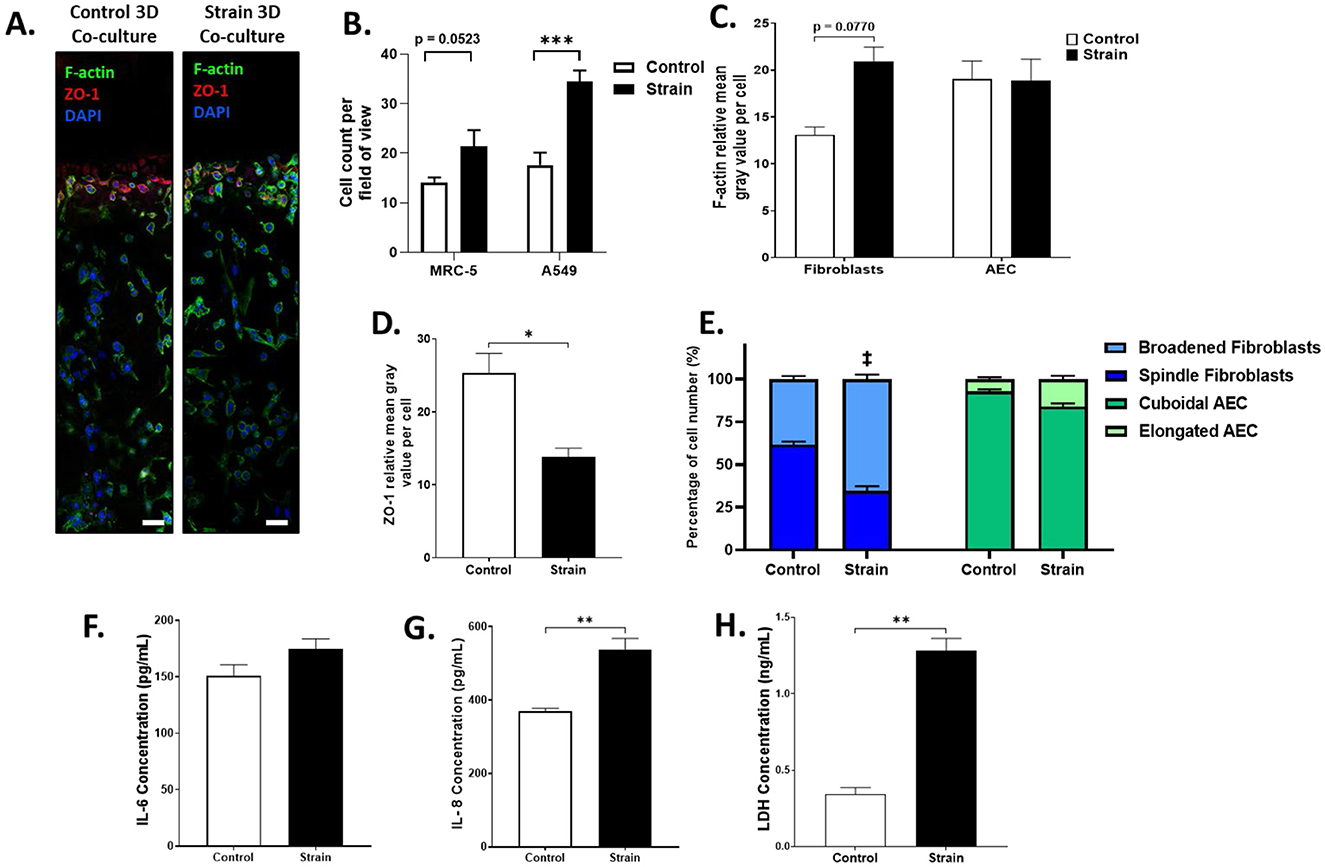 Series of images and graphs showing organoid growth and analysis over 21 days. (A) Microscopic images display organoid size progression on days 3, 9, and 21. (B-D) Bar charts illustrate the number, area, and diameter of organoids over time, showing significant growth changes. (E) Fluorescent images depict control and strained organoids with labeled components: F-actin, ZO-1, and DAPI. (F-I) Bar graphs compare organoid count, area, and F-actin/ZO-1 intensity between control and strain conditions, indicating significant differences. (J-L) Charts show IL-6 and LDH concentrations for control and strain conditions, highlighting variations.