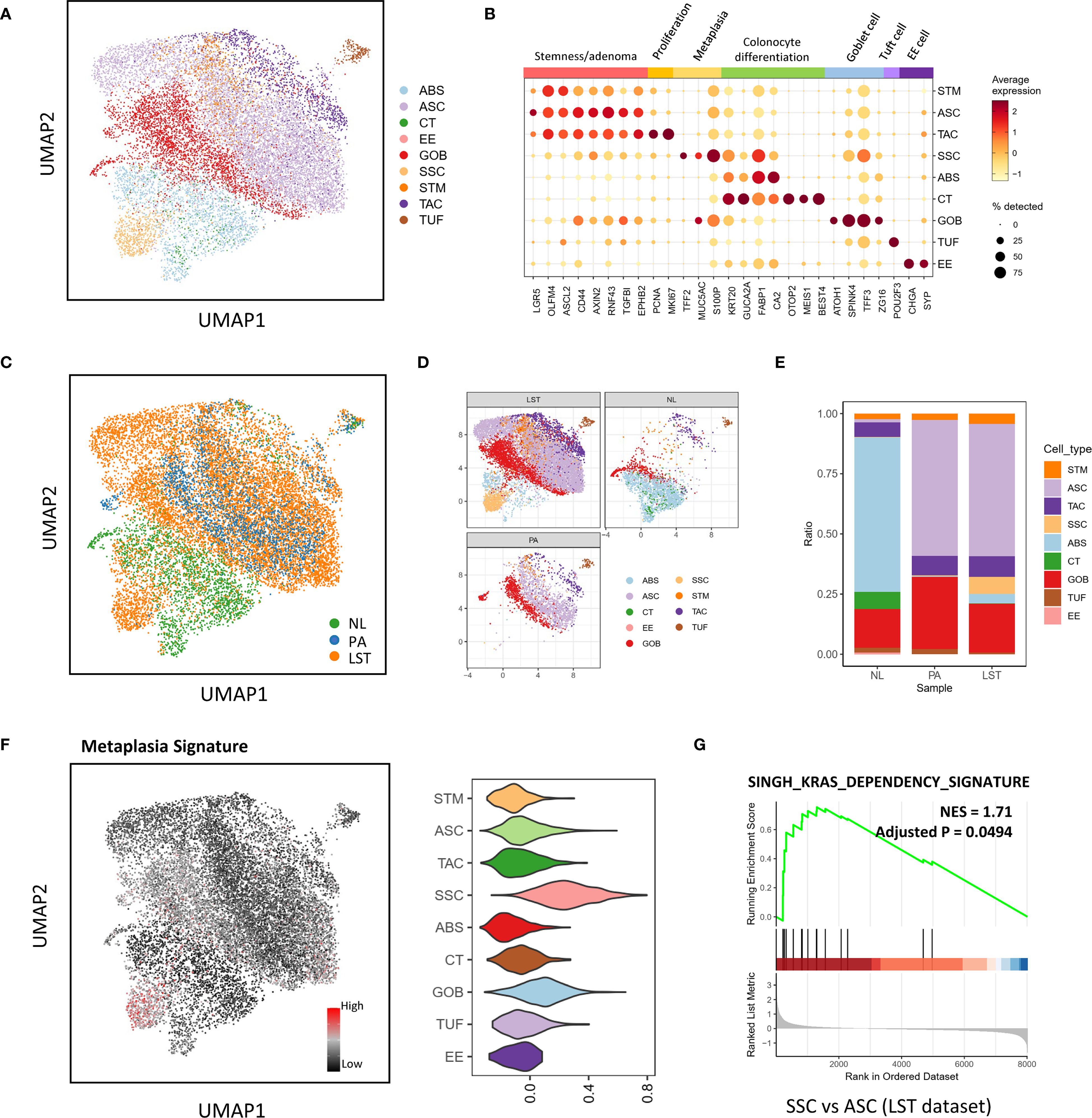 A multi-panel figure showing various analyses. Panel A: UMAP plot of cell types colored individually. Panel B: Dot plot showing gene expression related to cell differentiation and functions. Panel C: UMAP plot displaying three sample groups: NL, PA, and LST. Panel D: Four UMAP plots comparing cell types across different samples. Panel E: Stacked bar chart of cell type ratios in each sample group. Panel F: UMAP plot showing metaplasia signature with a color gradient. Panel G: Enrichment plot titled “SINGH_KRAS_DEPENDENCY_SIGNATURE” with a significant enrichment score.