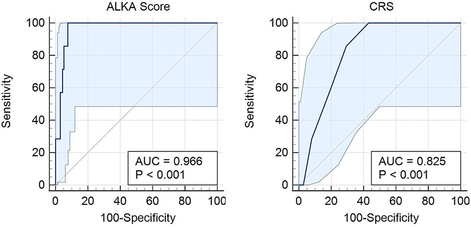 Two ROC curves compare the diagnostic performance of the ALKA Score and CRS. The ALKA Score curve, on the left, has an AUC of 0.966. The CRS curve, on the right, shows an AUC of 0.825. Both curves indicate statistical significance with P-values less than 0.001.