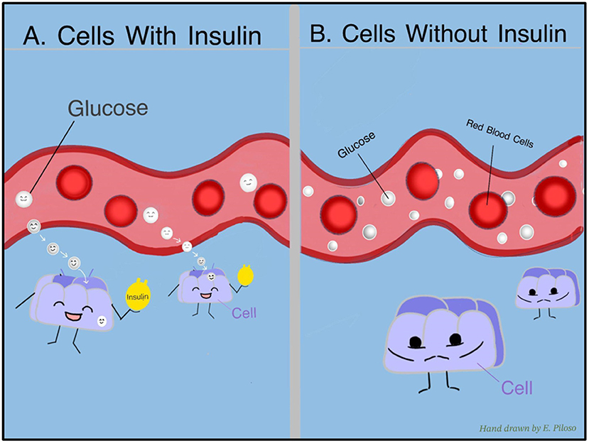 Illustration comparing cells with and without insulin. On the left, insulin helps cells absorb glucose from the bloodstream, depicted by smiling cells with glucose and insulin symbols. On the right, without insulin, cells cannot absorb glucose, shown by frowning cells. Red blood cells and glucose molecules are present in both bloodstream depictions.