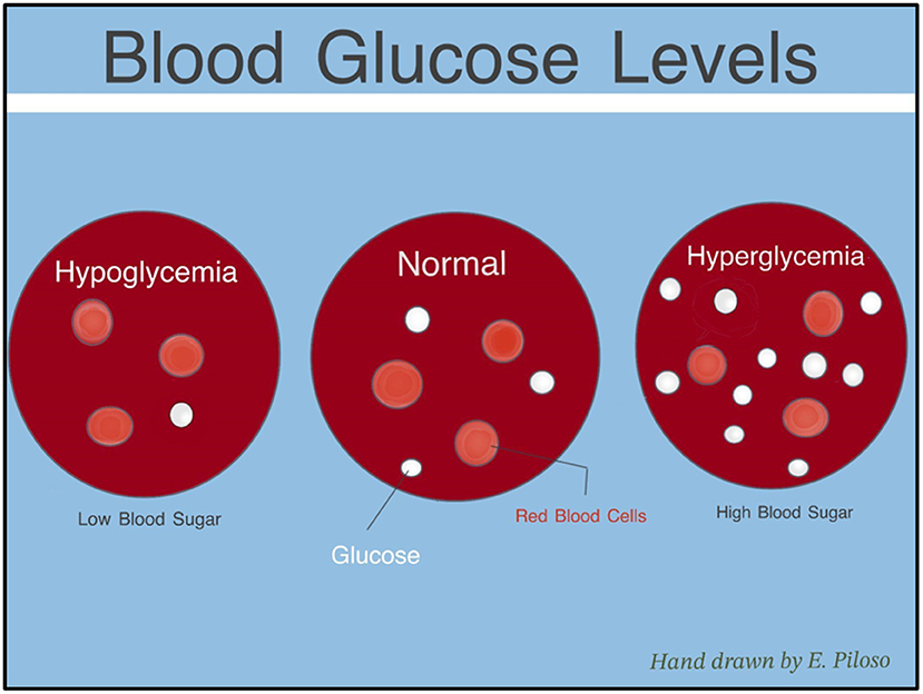 Three diagrams illustrate blood glucose levels. The first shows hypoglycemia with fewer white glucose dots. The second shows normal levels with moderate glucose presence. The third shows hyperglycemia with more white glucose dots. Each diagram includes red blood cells.