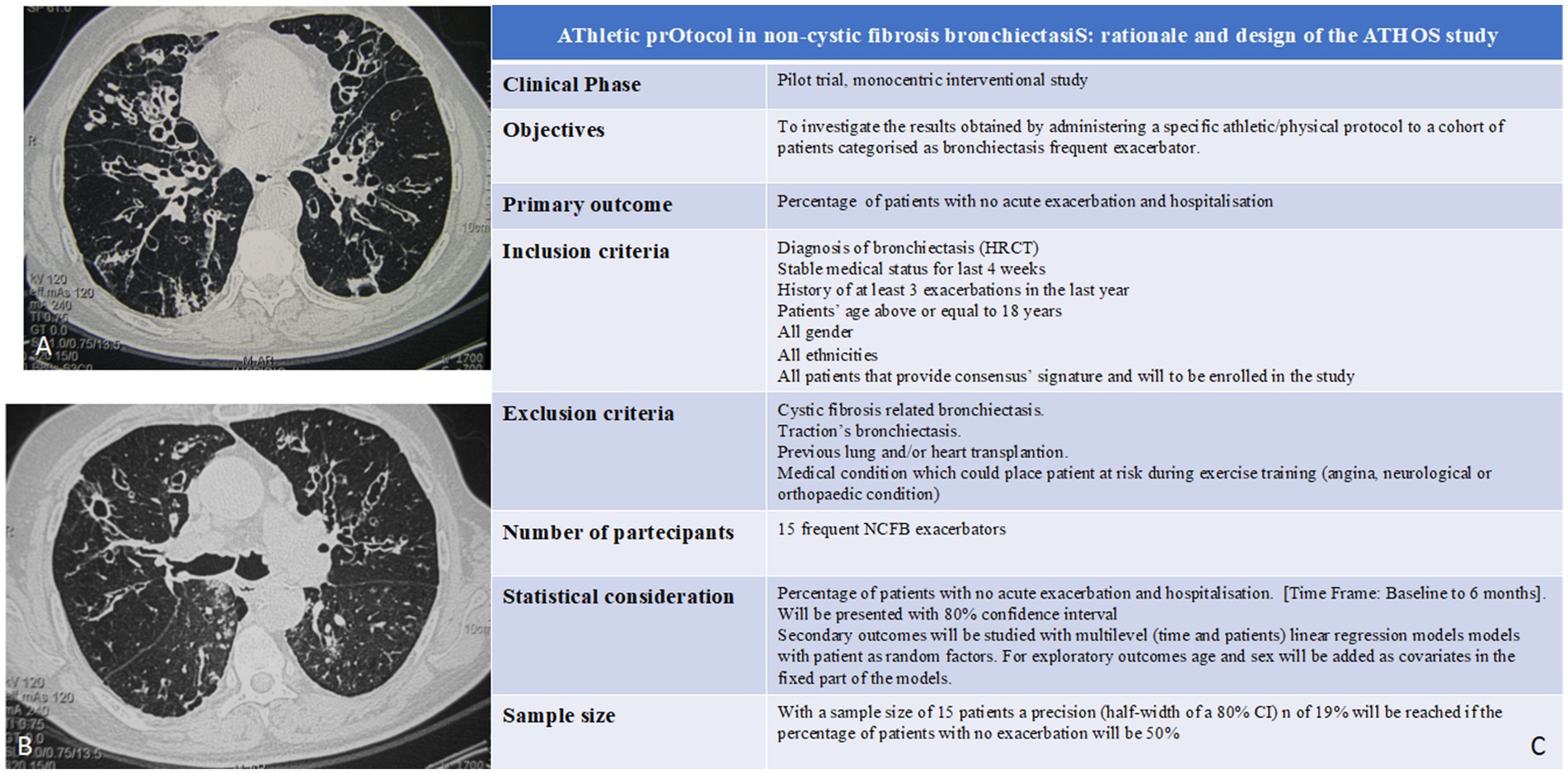 CT scan images of lungs labeled A and B; both show bronchiectasis. Adjacent is a table titled