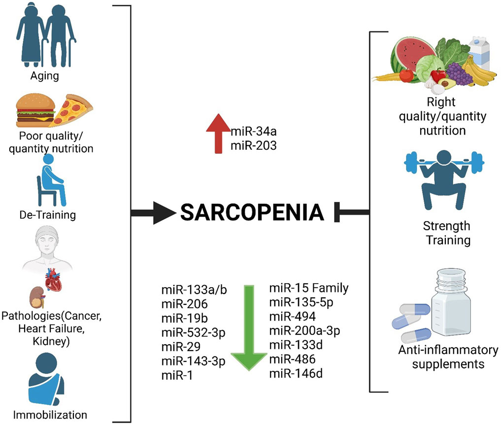 Diagram illustrating factors influencing sarcopenia. Left factors include aging, poor nutrition, de-training, pathologies, and immobilization, leading to increased miR-34a and miR-203 levels. Right factors include proper nutrition, strength training, and anti-inflammatory supplements, associated with decreased levels of various microRNAs, such as miR-133a/b, miR-206, and others.