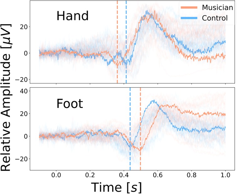 Two line graphs show relative amplitude of neural responses over one second for musician and control groups following thermal stimulation to the hand (top) and foot (bottom). The y-axis represents relative amplitude in microvolts and the x-axis represents time in seconds. In both graphs, orange represents musicians and blue represents controls, with shaded areas indicating variability. Musicians show earlier and higher peak amplitudes than controls for the hand stimulation and a longer latency for the foot stimulation compared to the controls. Vertical dashed lines mark response onset times fot the highlighted examples, with musicians responding earlier for the hands and later for the feet.